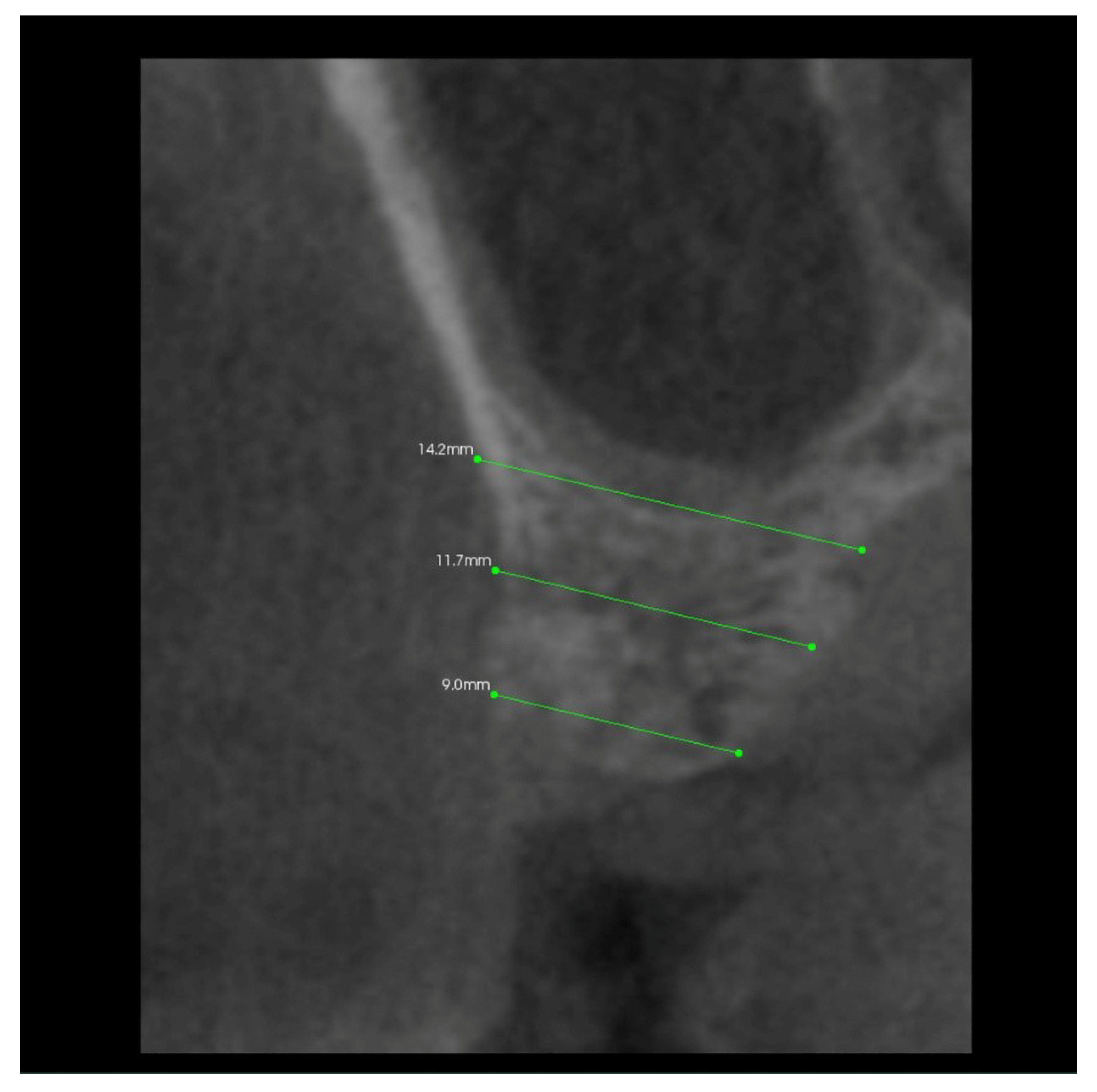 Coatings 12 00247 g006