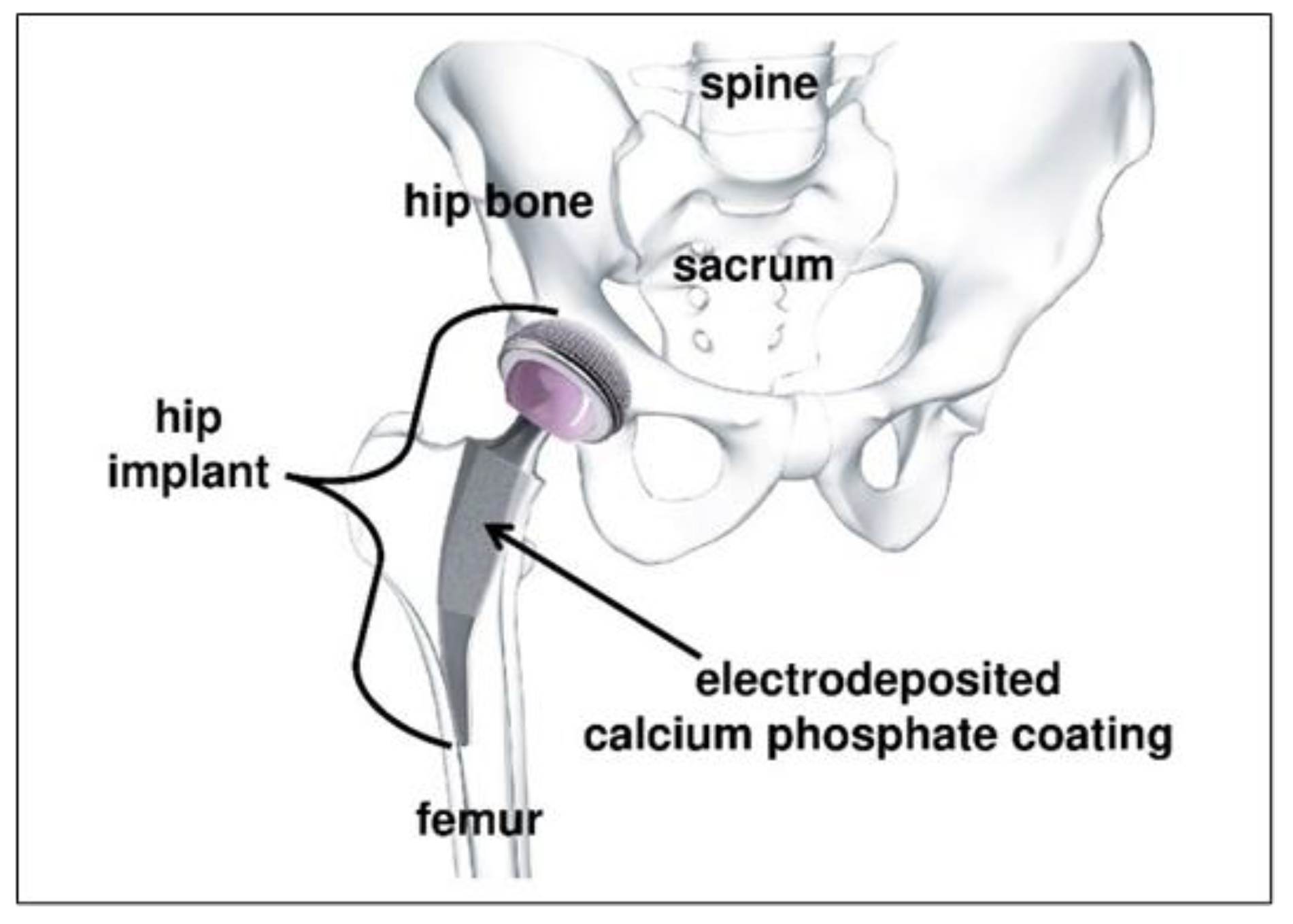 Coatings 12 00539 g001
