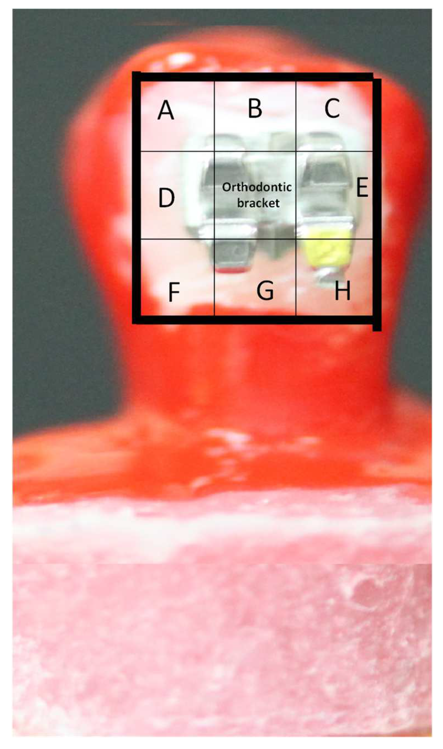 Coatings 12 00550 g003