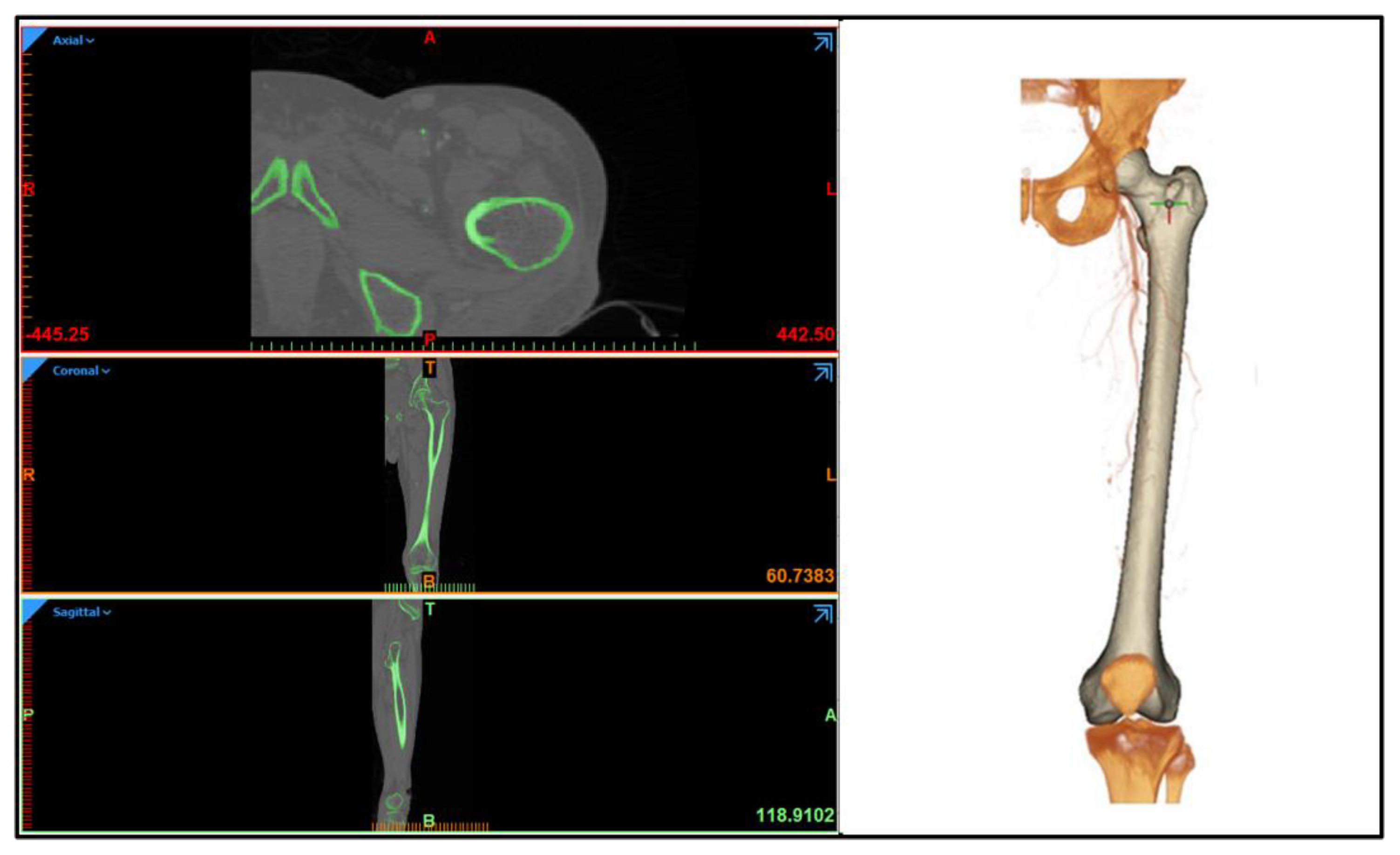 Coatings 12 00839 g0a2