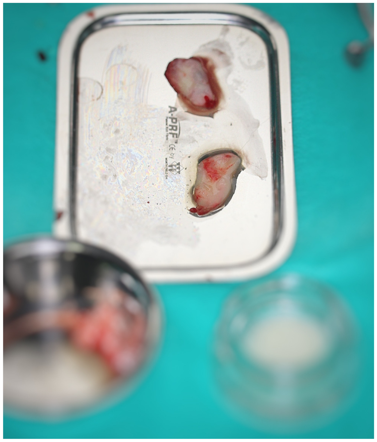 Coatings 12 00909 g001