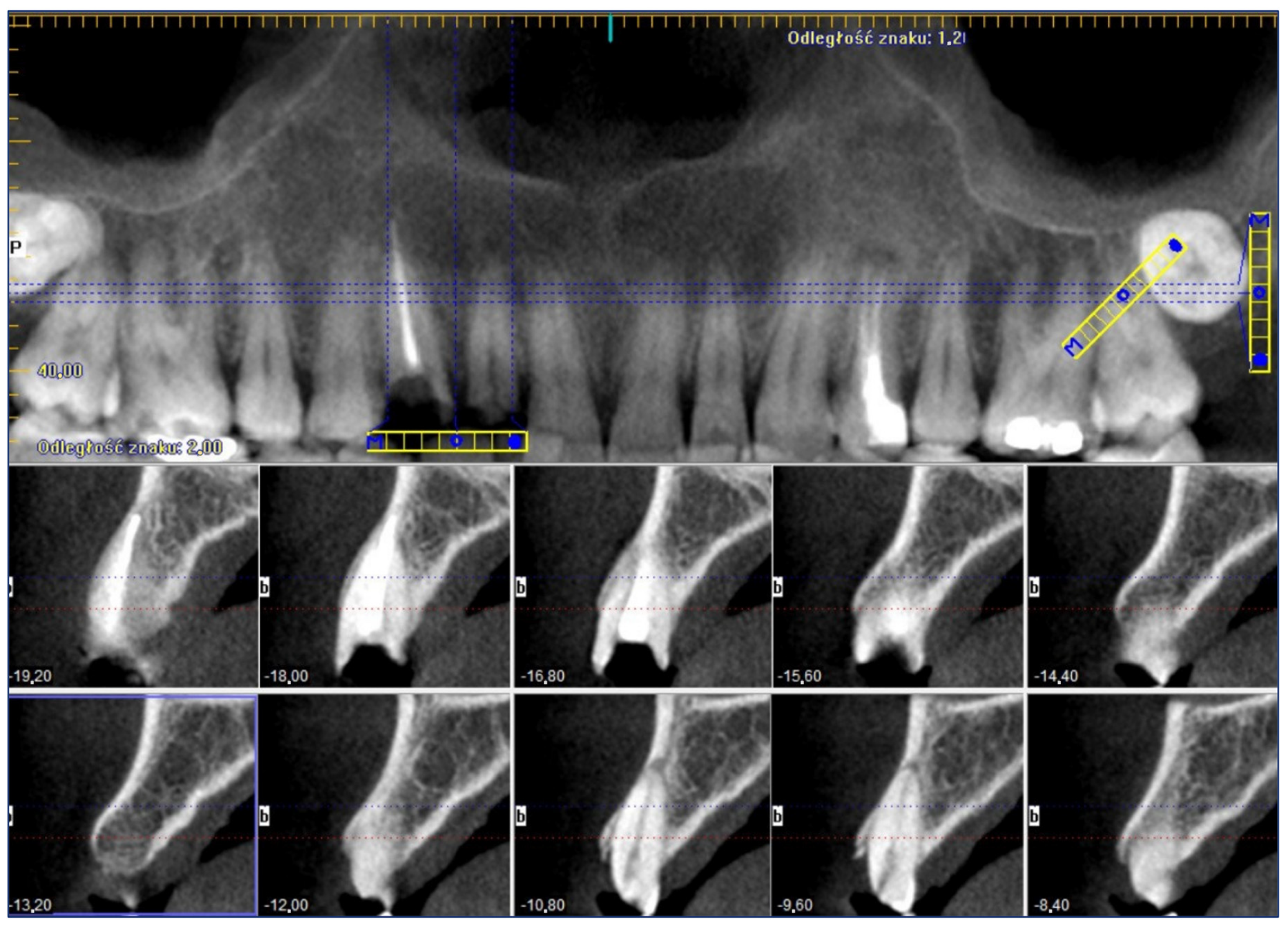 Coatings 12 00909 g002