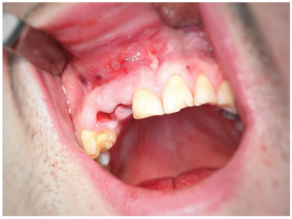 Coatings 12 00909 g004