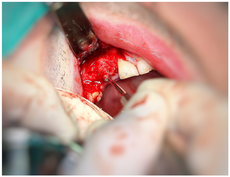 Coatings 12 00909 g005