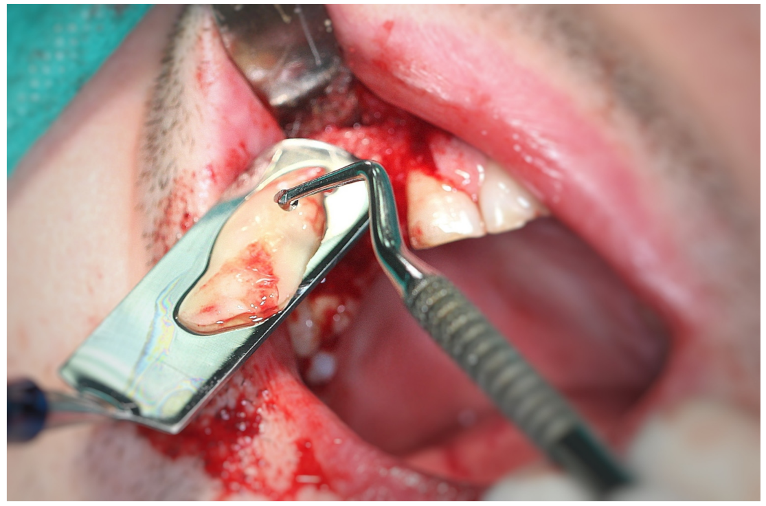 Coatings 12 00909 g006