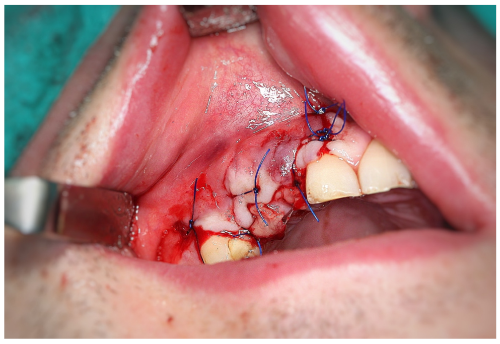 Coatings 12 00909 g007