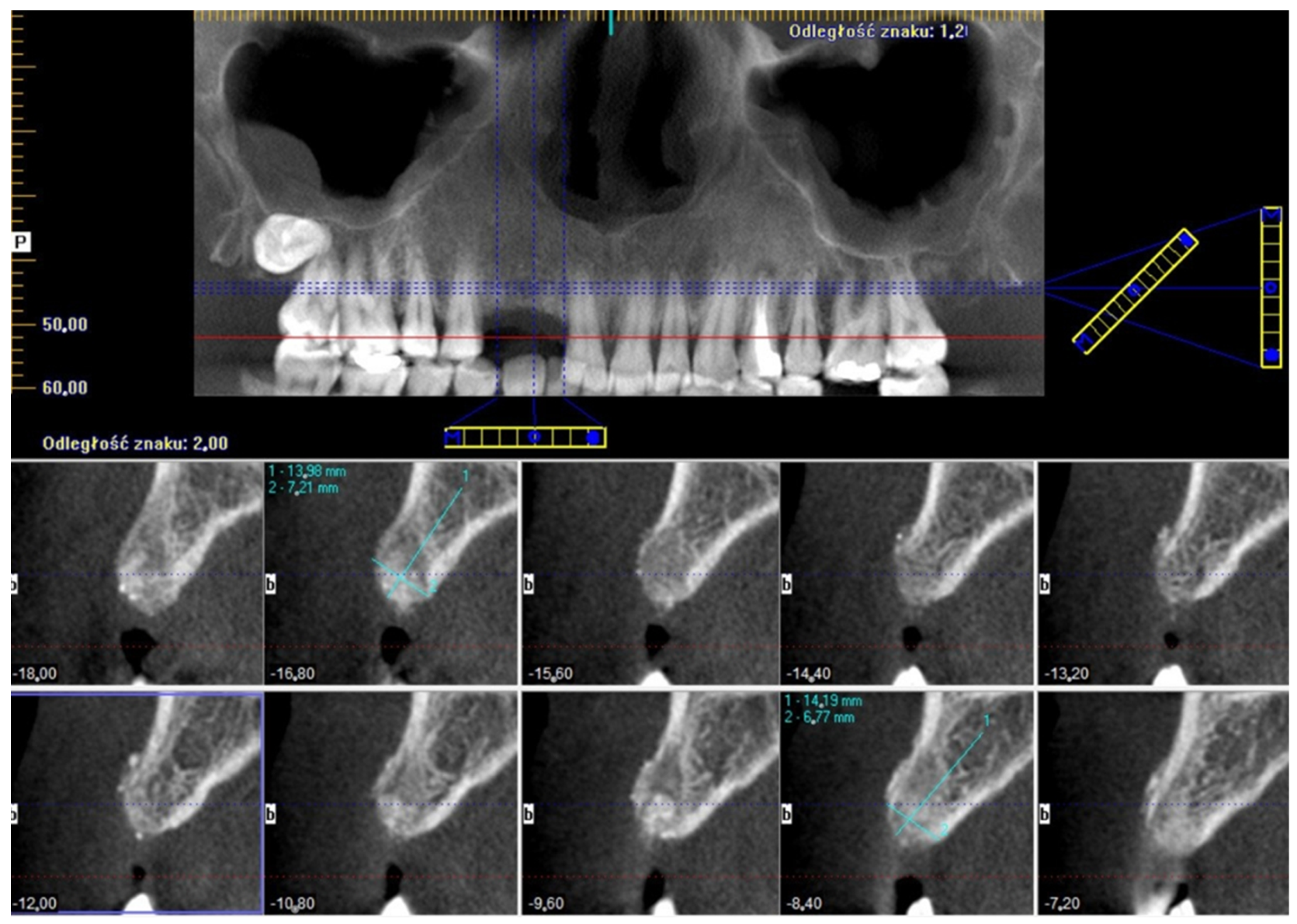 Coatings 12 00909 g009