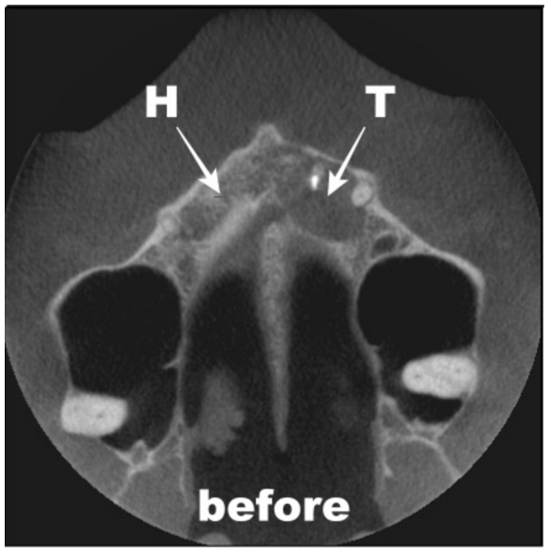 Coatings 12 00909 g010
