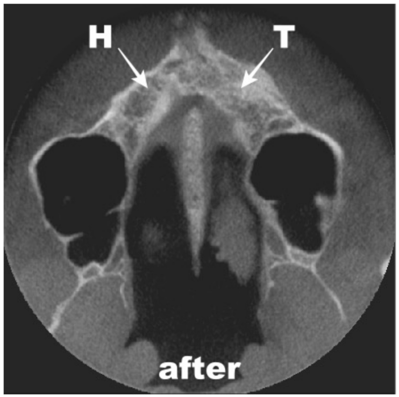 Coatings 12 00909 g011