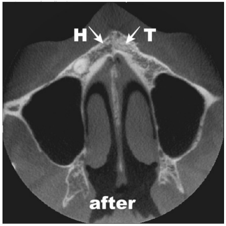 Coatings 12 00909 g013