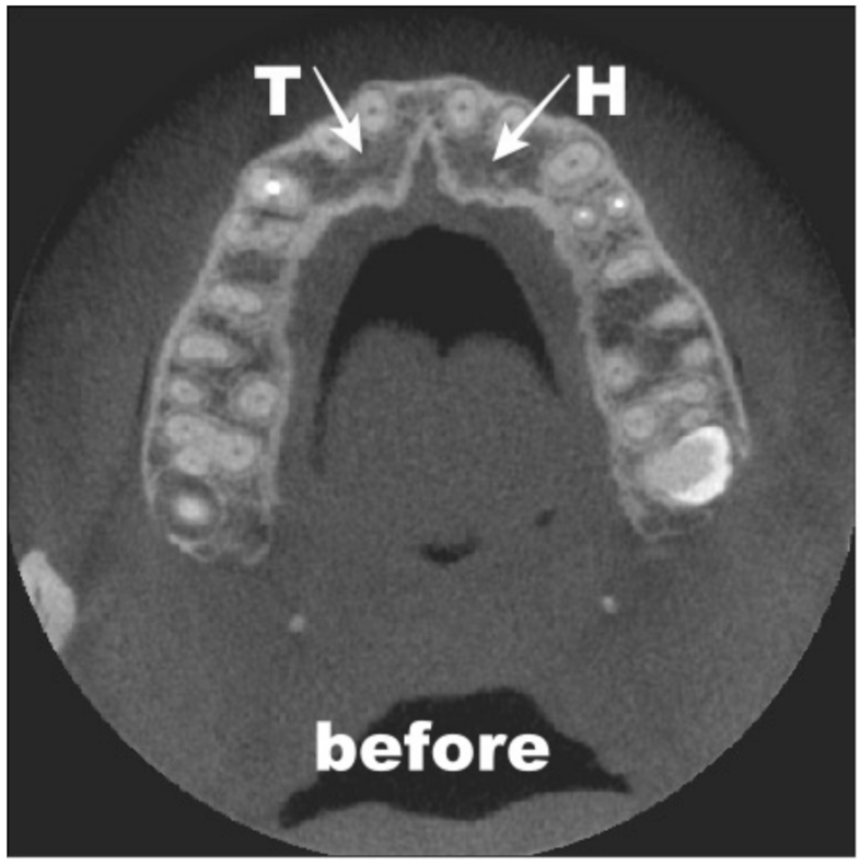Coatings 12 00909 g014