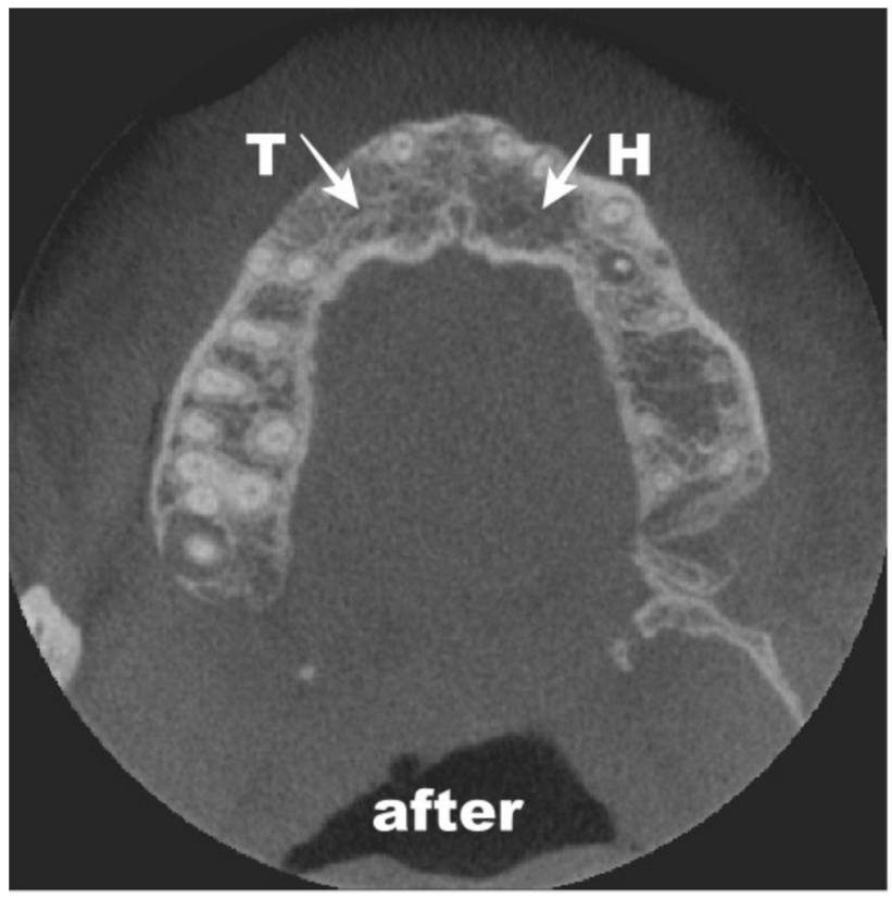 Coatings 12 00909 g015