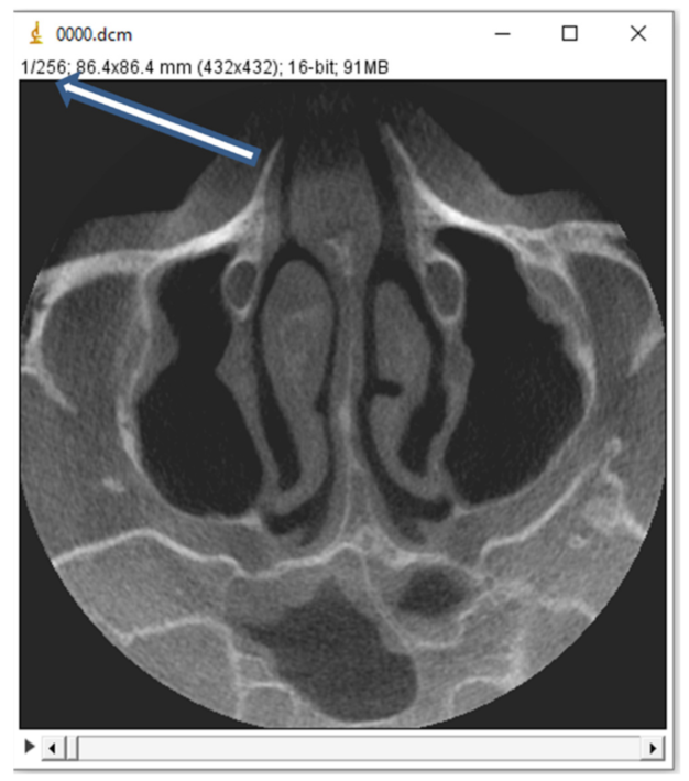 Coatings 12 00909 g016