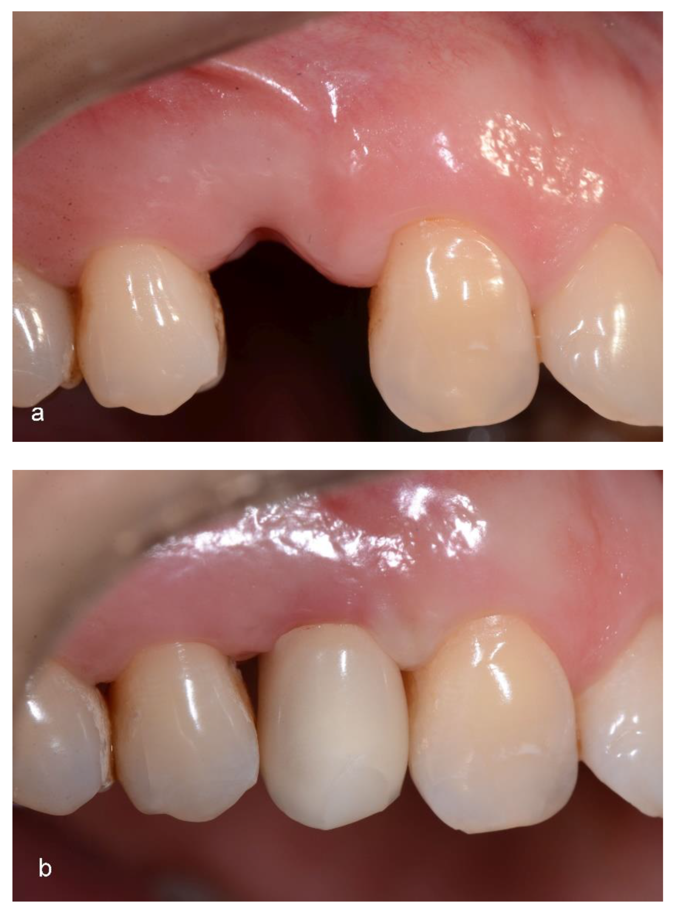 Coatings 12 01295 g002a