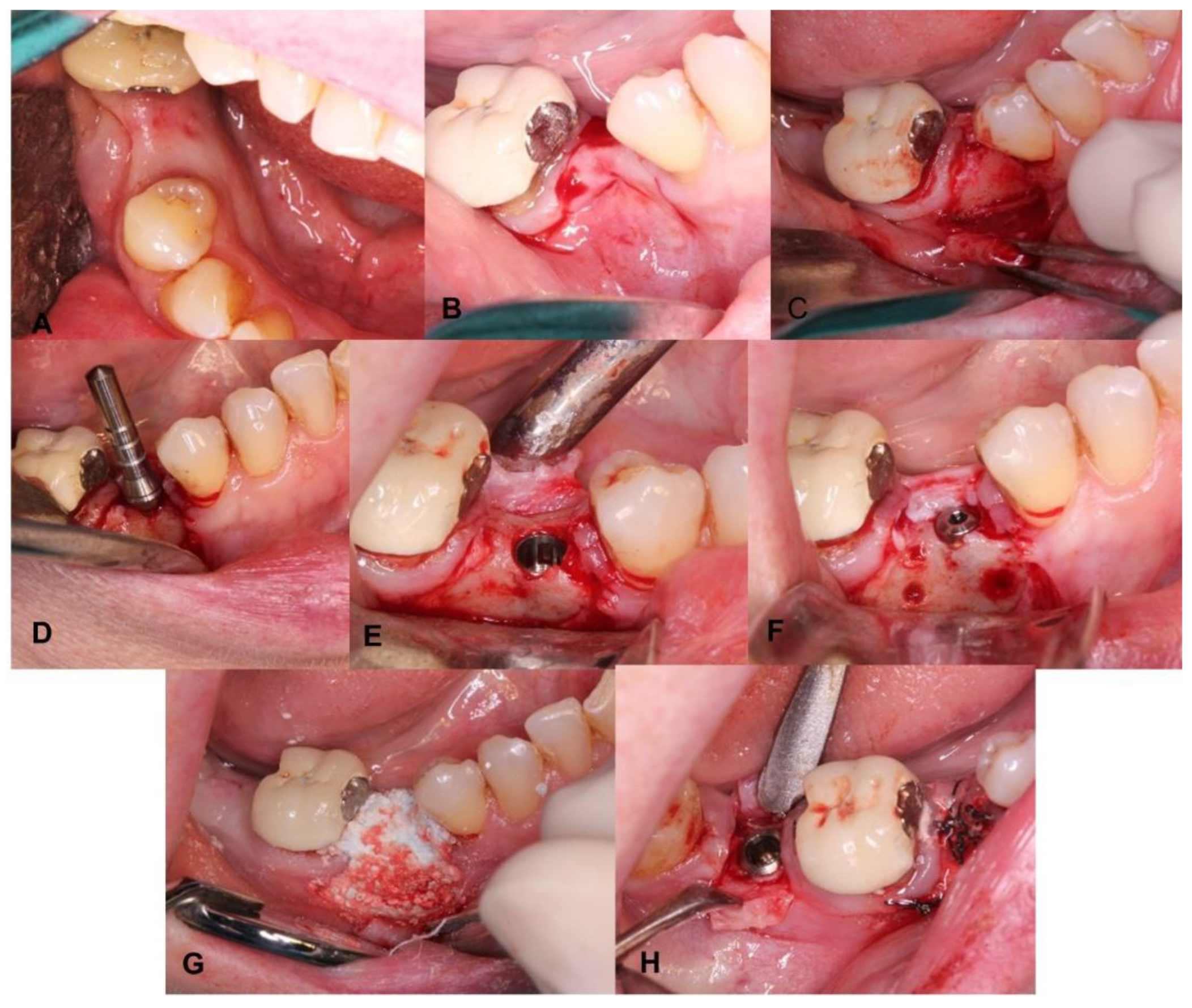 Coatings 12 01350 g003 Coatings 12 01350 g003