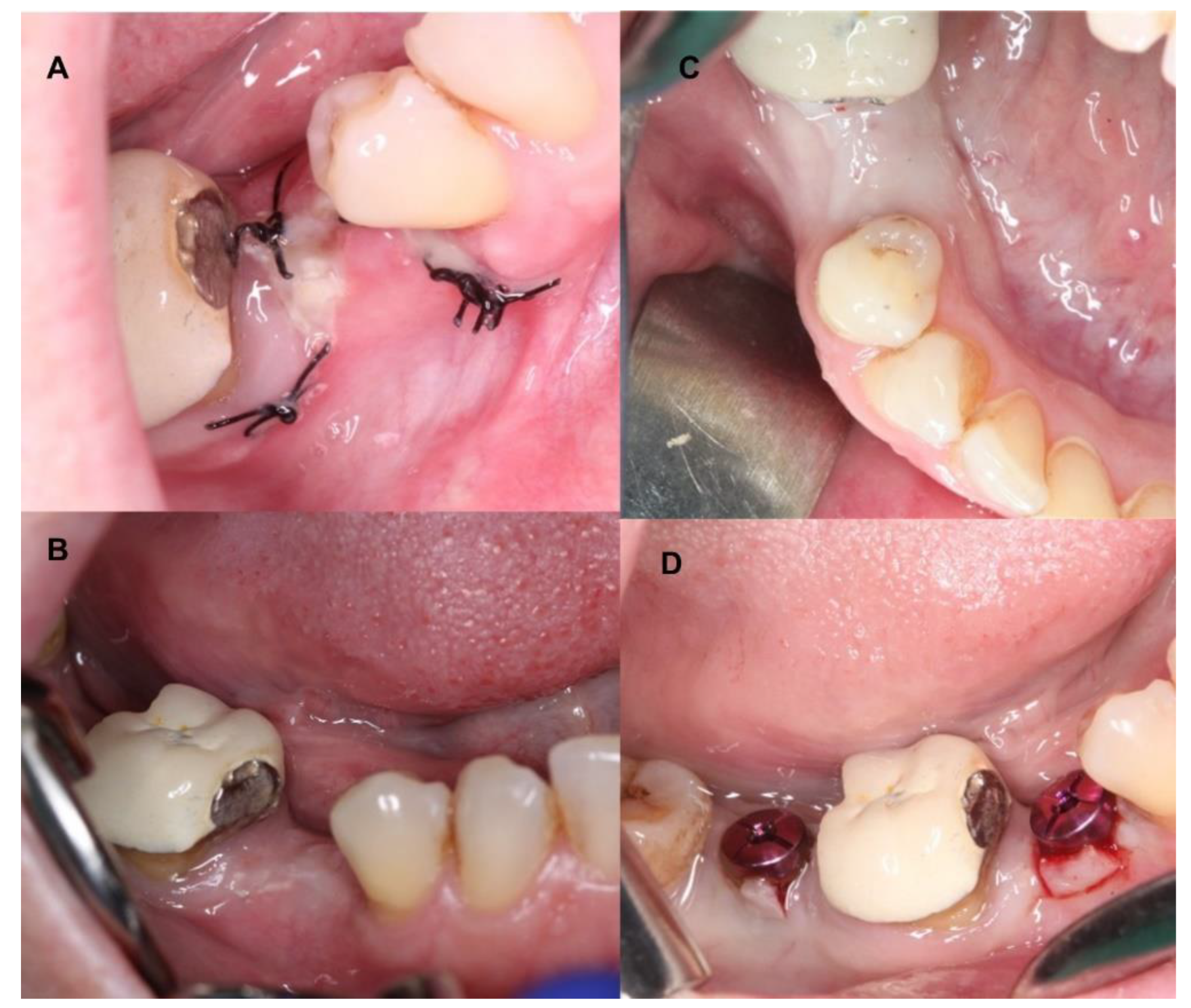 Coatings 12 01350 g004 Coatings 12 01350 g004