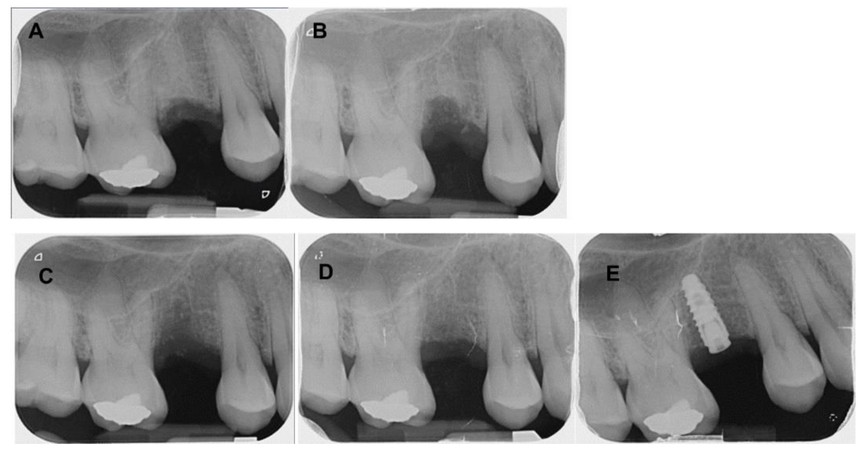 Coatings 12 01350 g005 Coatings 12 01350 g005