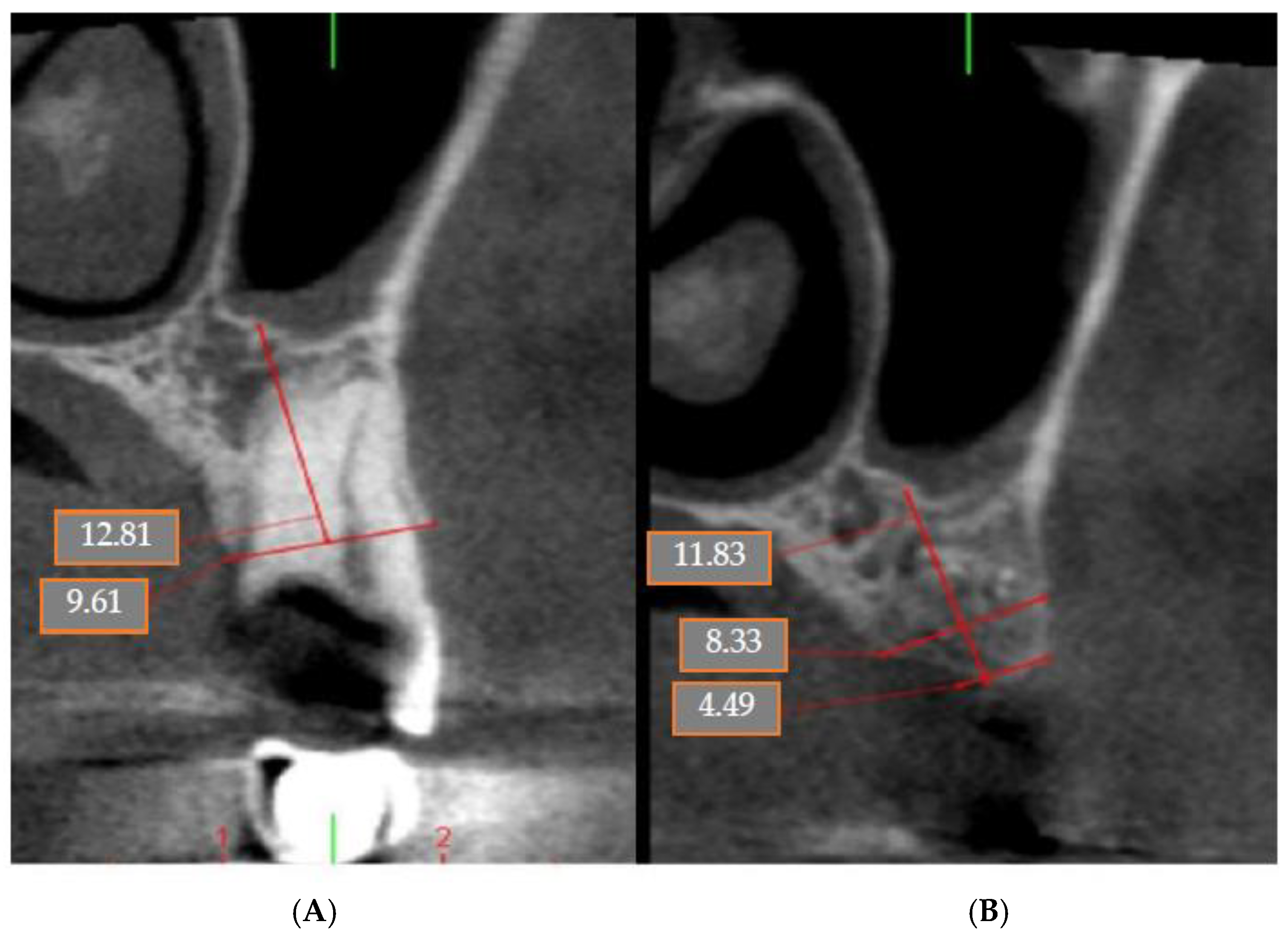 Coatings 12 01350 g006 Coatings 12 01350 g006