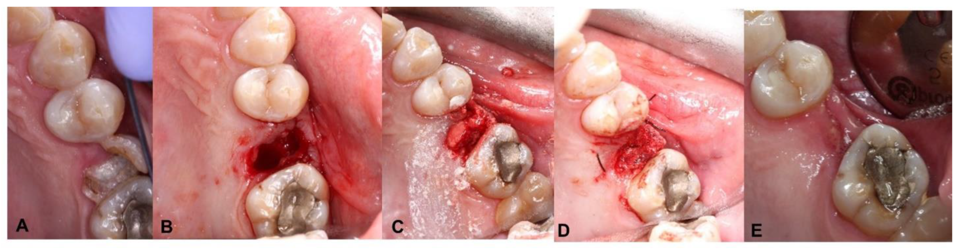 Coatings 12 01350 g007 Coatings 12 01350 g007