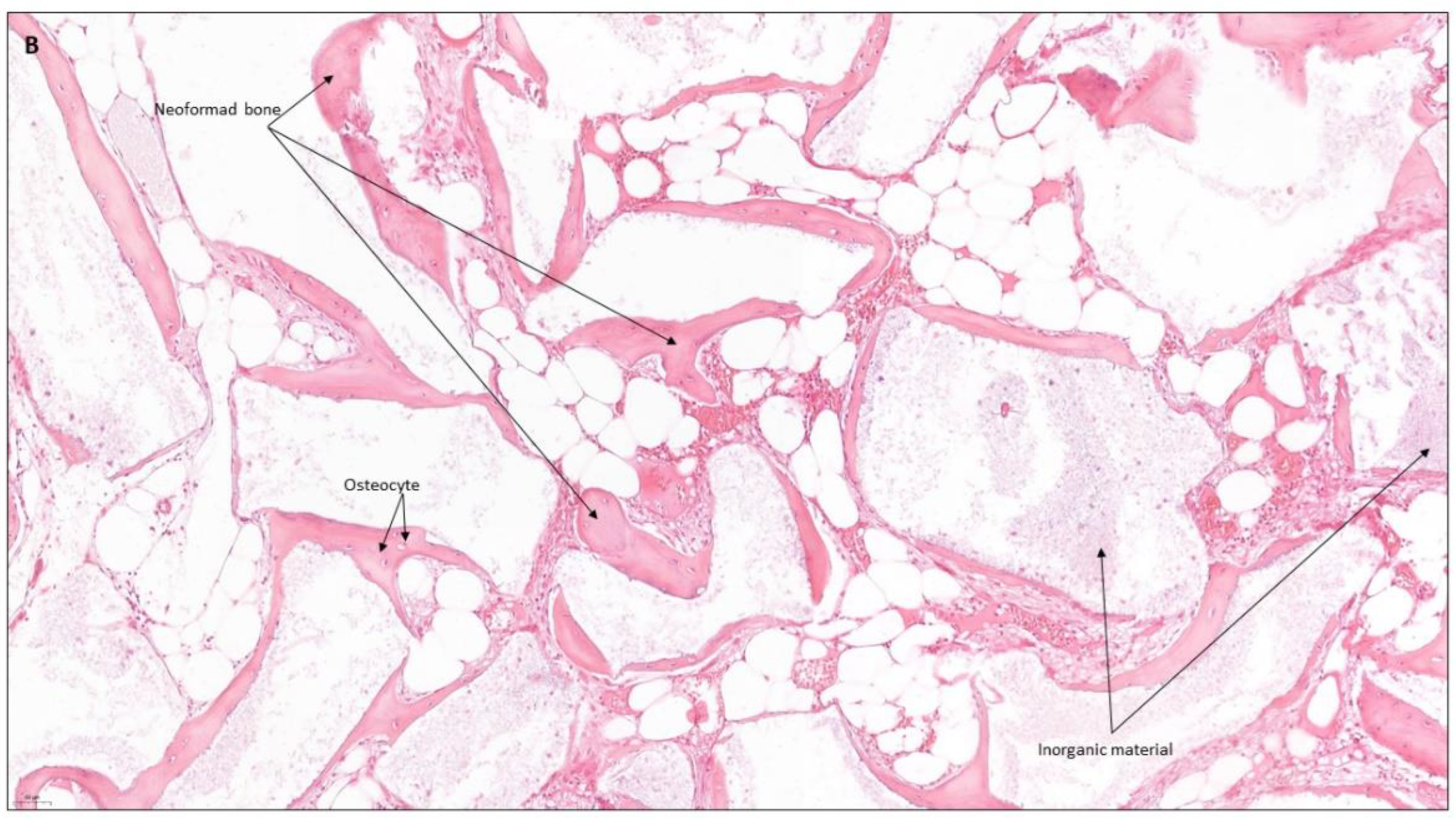 Coatings 12 01350 g008b Coatings 12 01350 g008b