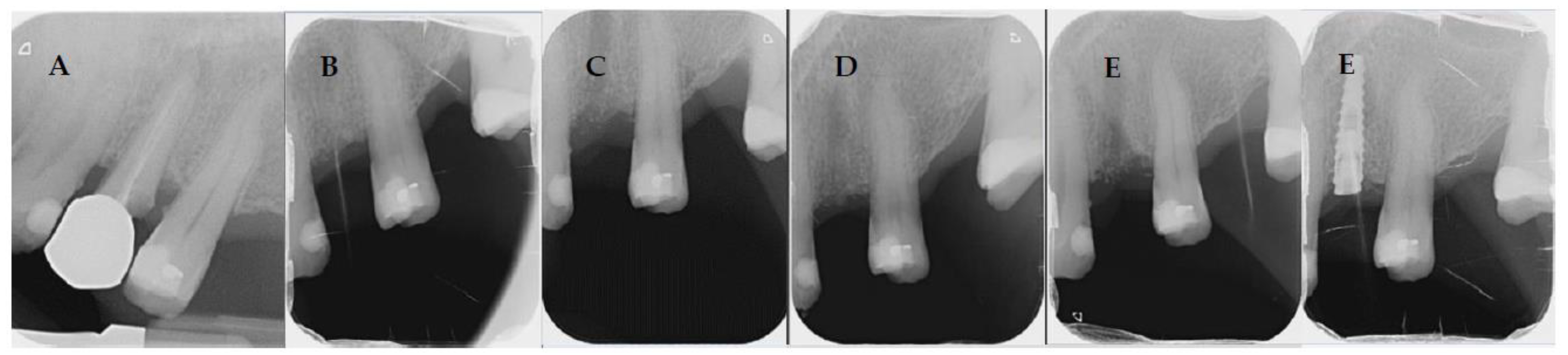 Coatings 12 01350 g009 Coatings 12 01350 g009