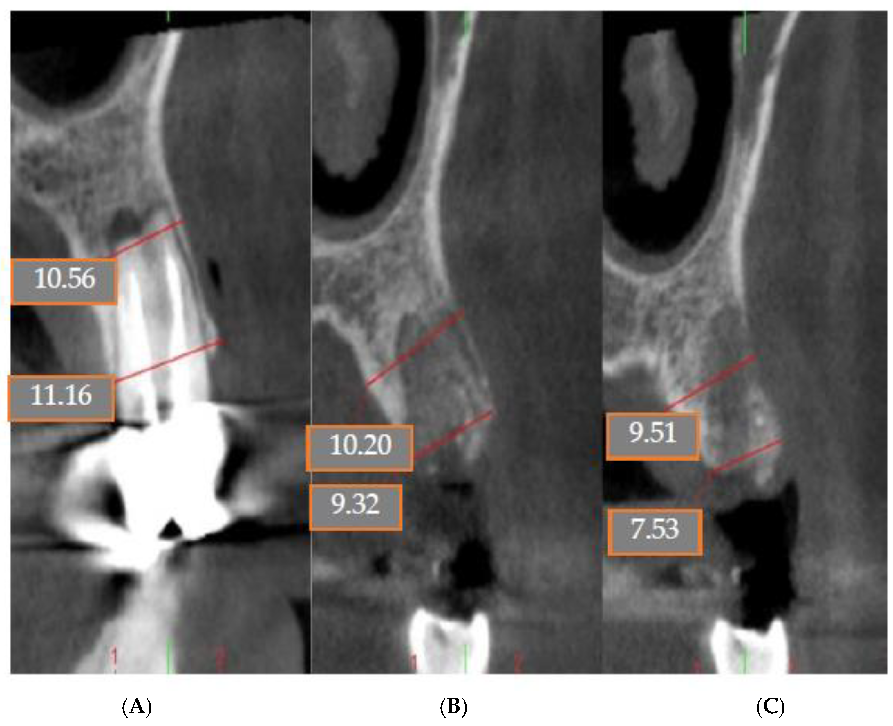 Coatings 12 01350 g010 Coatings 12 01350 g010