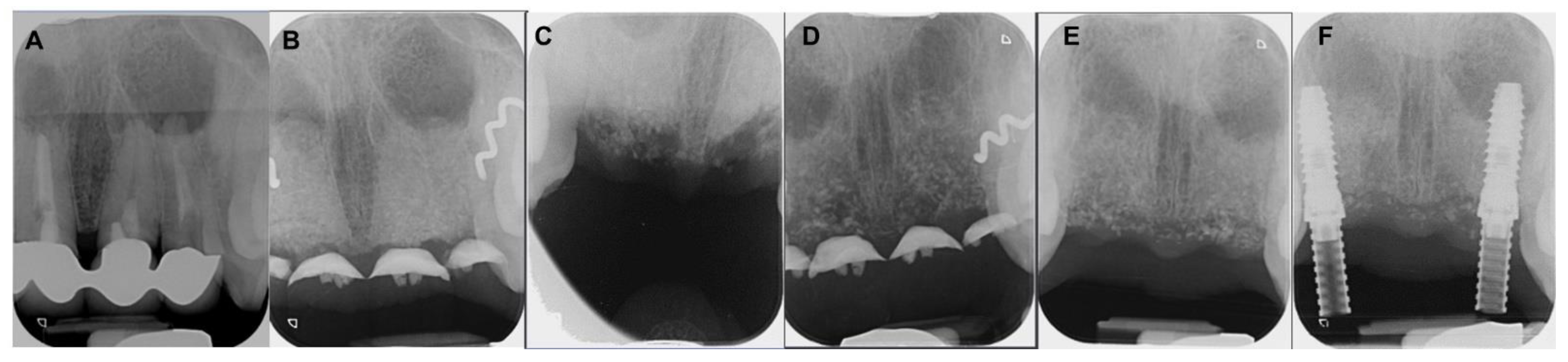 Coatings 12 01350 g013 Coatings 12 01350 g013