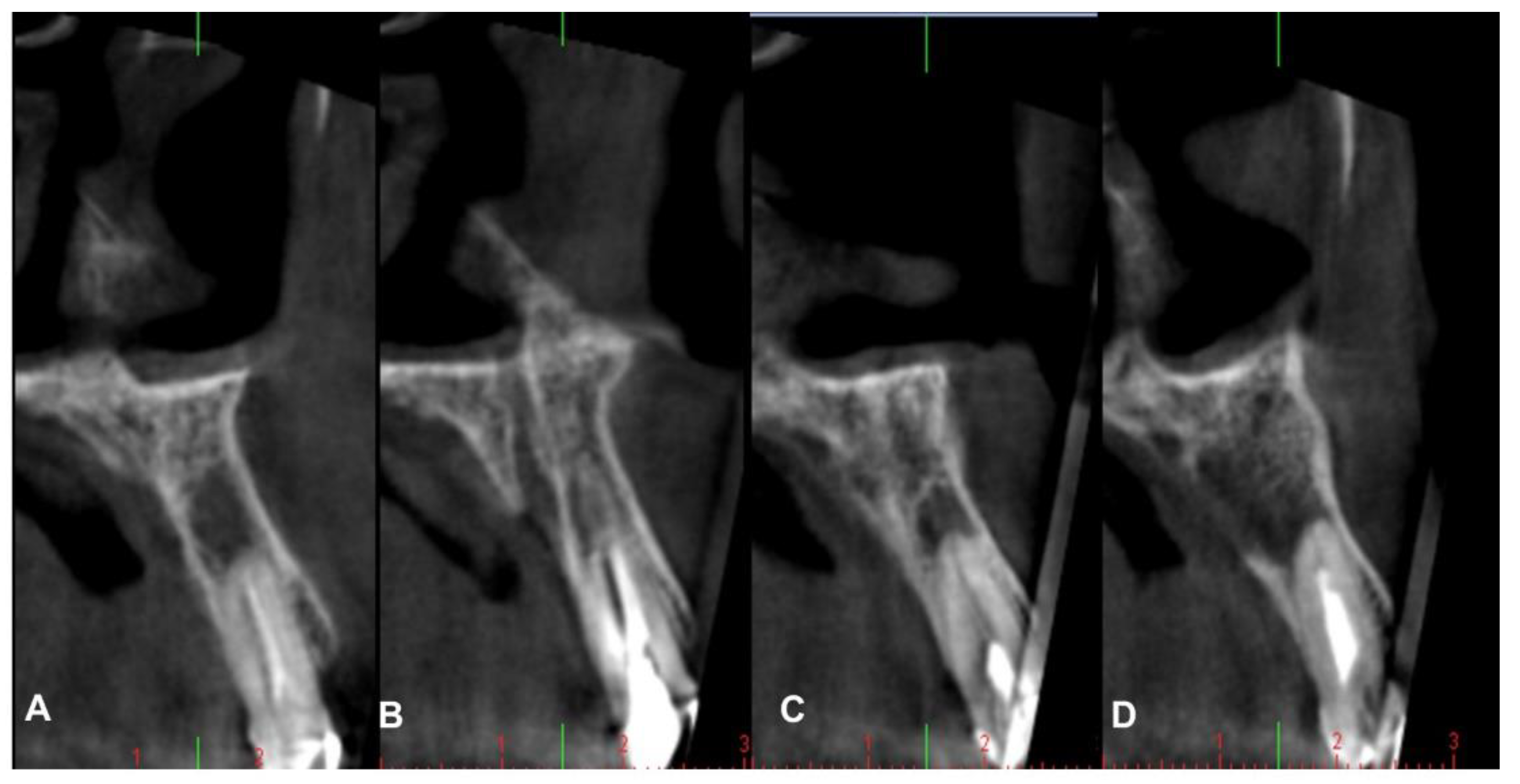 Coatings 12 01350 g014 Coatings 12 01350 g014