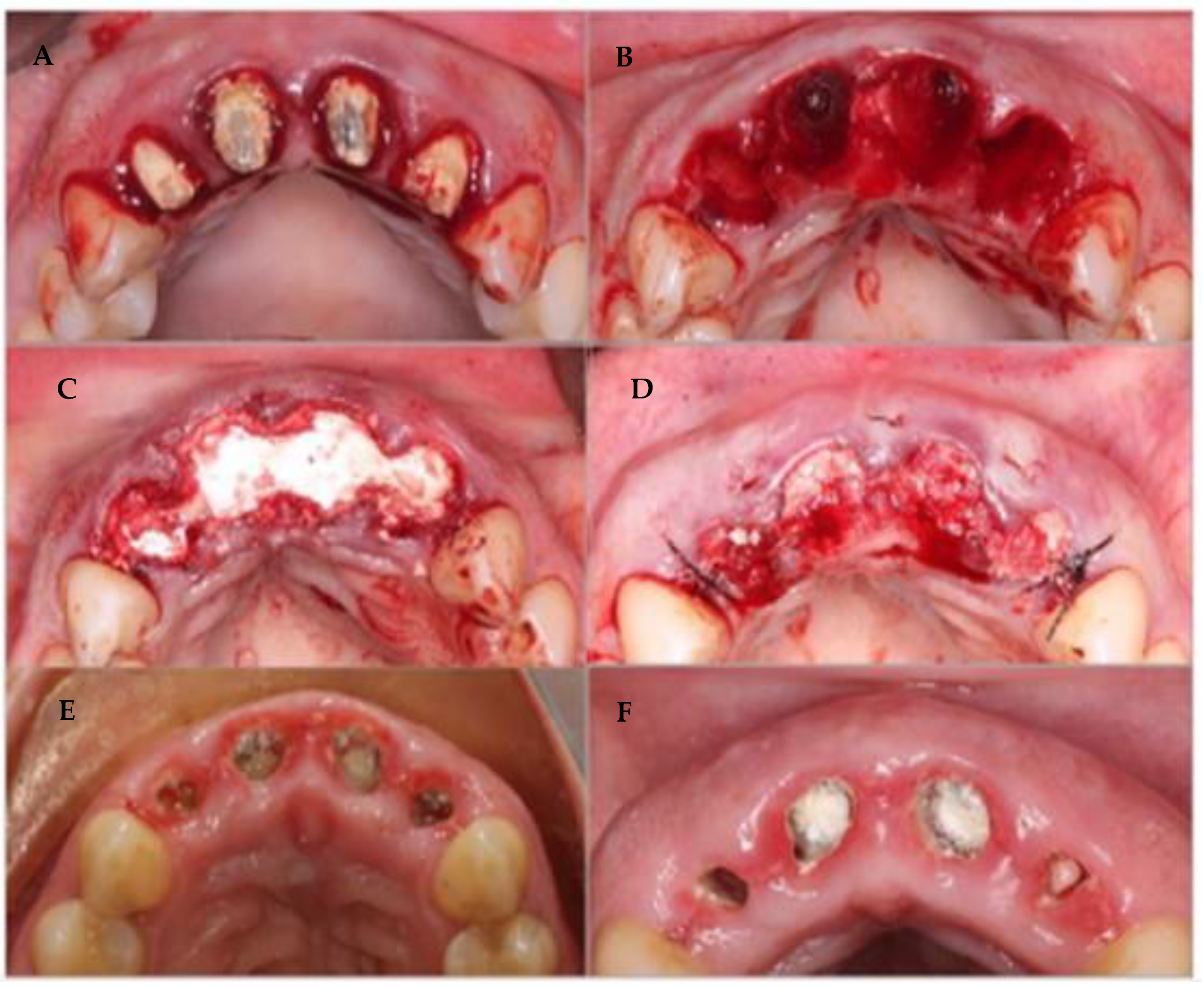 Coatings 12 01350 g015 Coatings 12 01350 g015