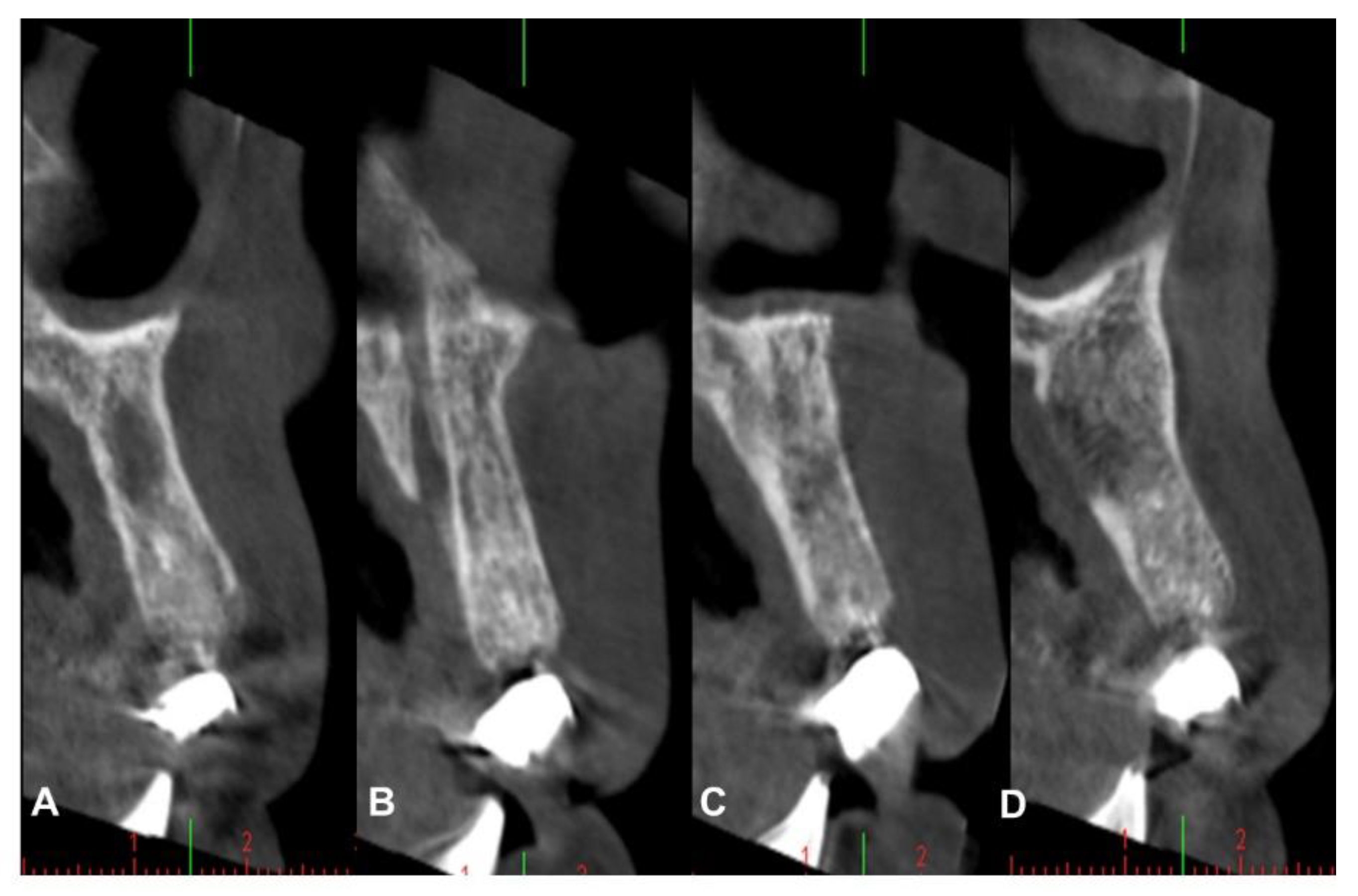 Coatings 12 01350 g016 Coatings 12 01350 g016