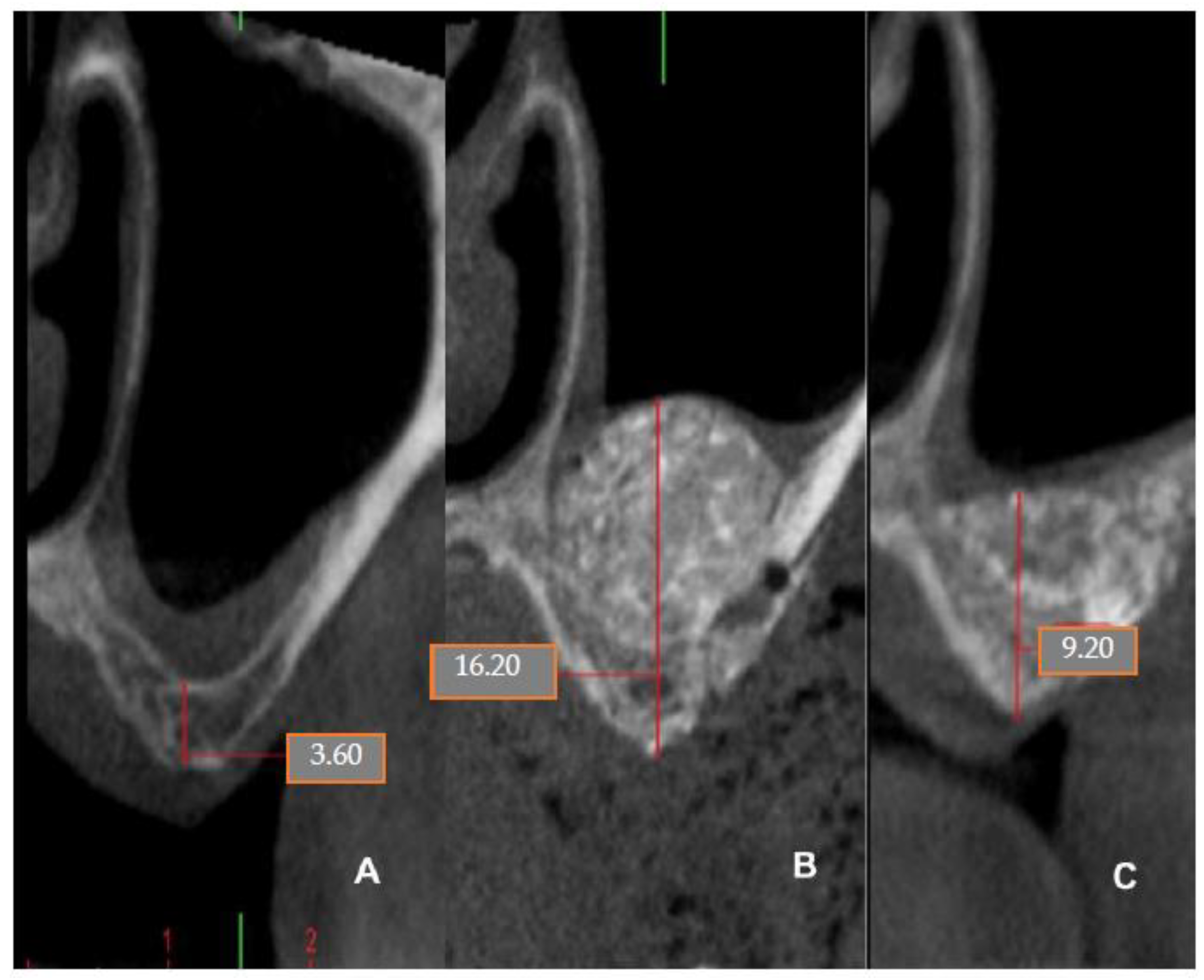 Coatings 12 01350 g018 Coatings 12 01350 g018