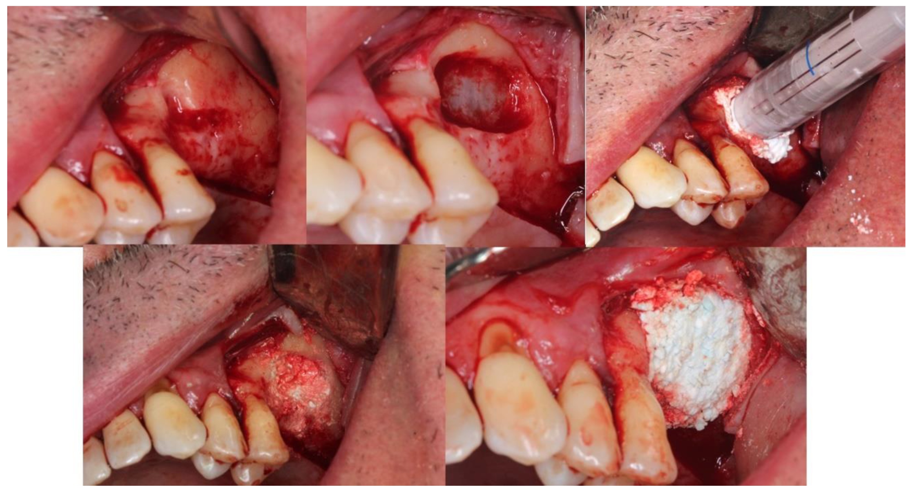 Coatings 12 01350 g019 Coatings 12 01350 g019