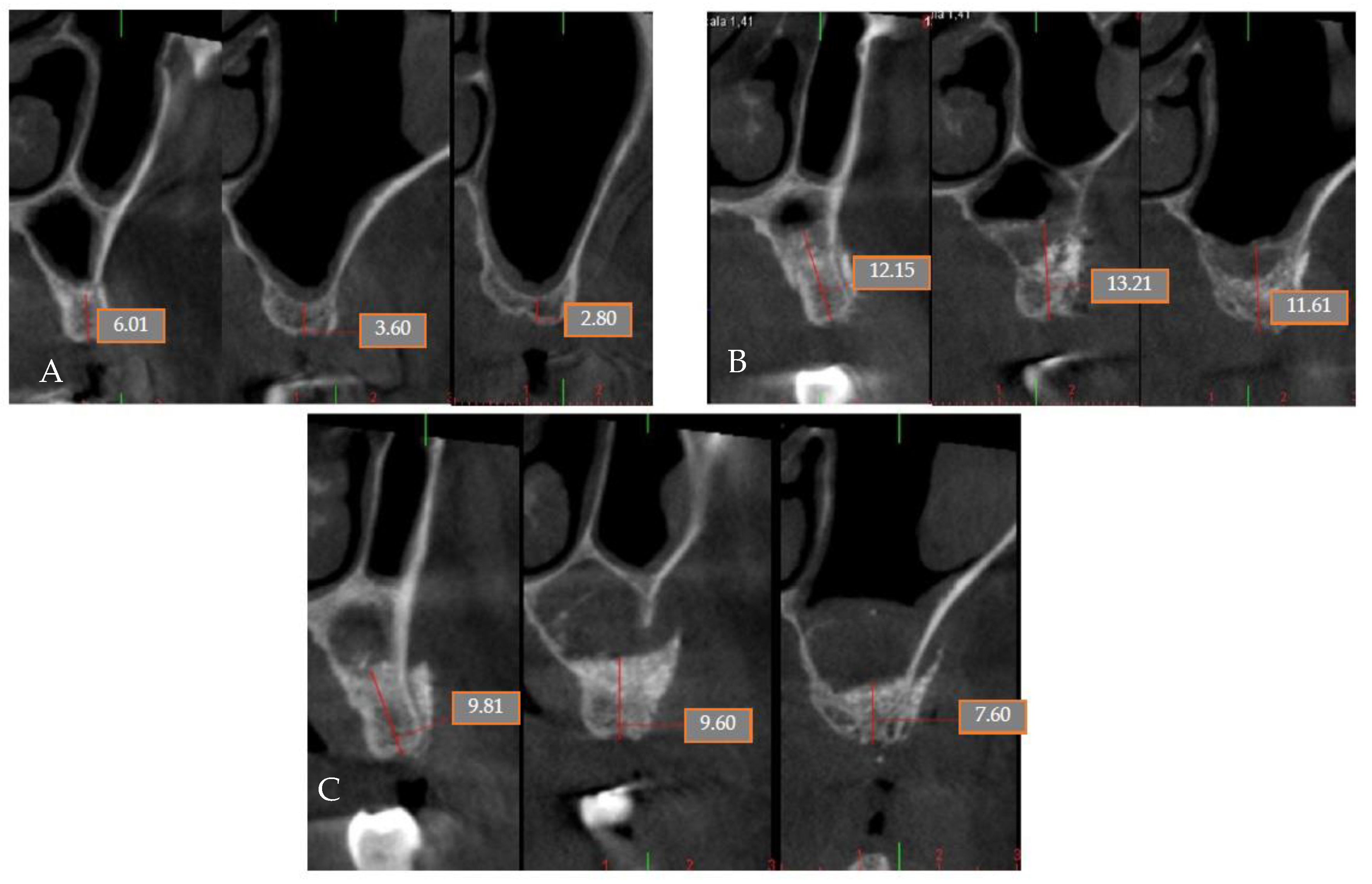 Coatings 12 01350 g021 Coatings 12 01350 g021