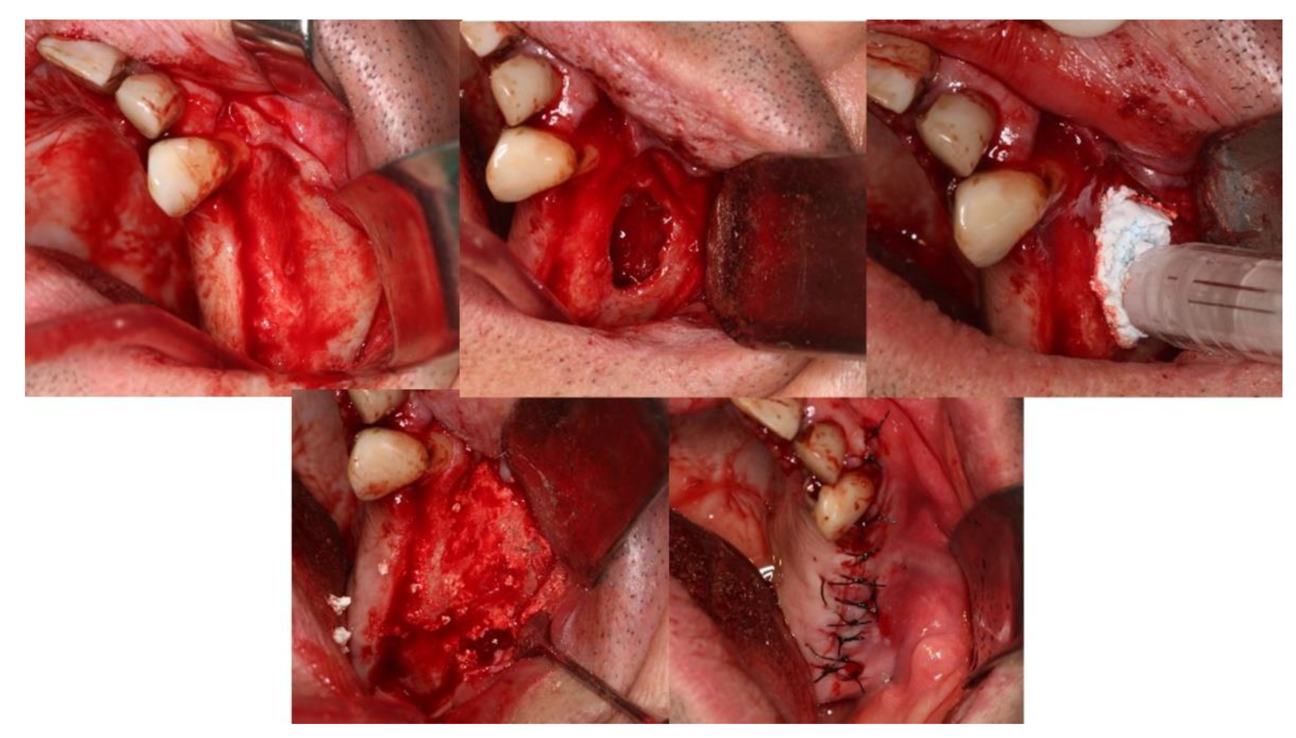 Coatings 12 01350 g022 Coatings 12 01350 g022