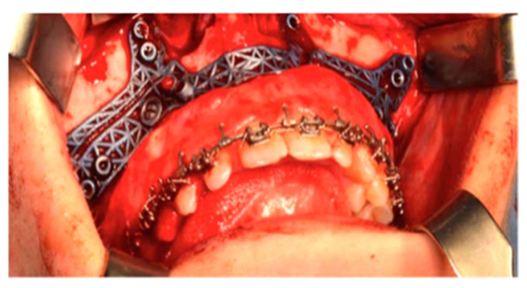 Coatings 12 01463 g007 Coatings 12 01463 g007