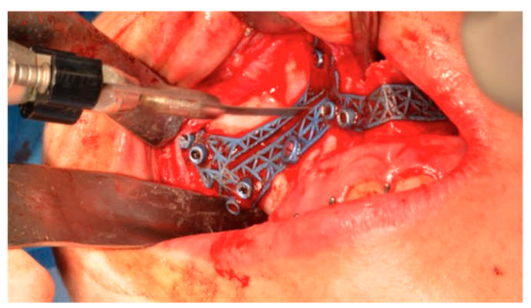 Coatings 12 01463 g008 Coatings 12 01463 g008