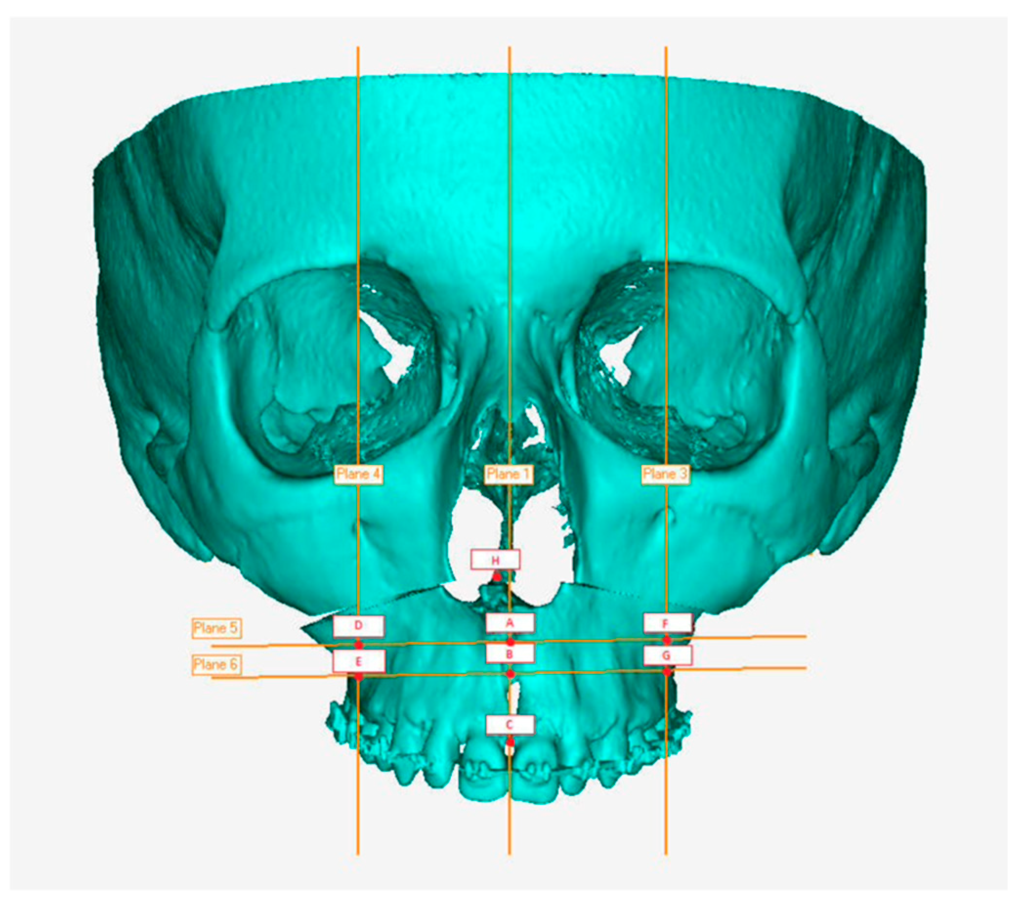Coatings 12 01463 g010 Coatings 12 01463 g010