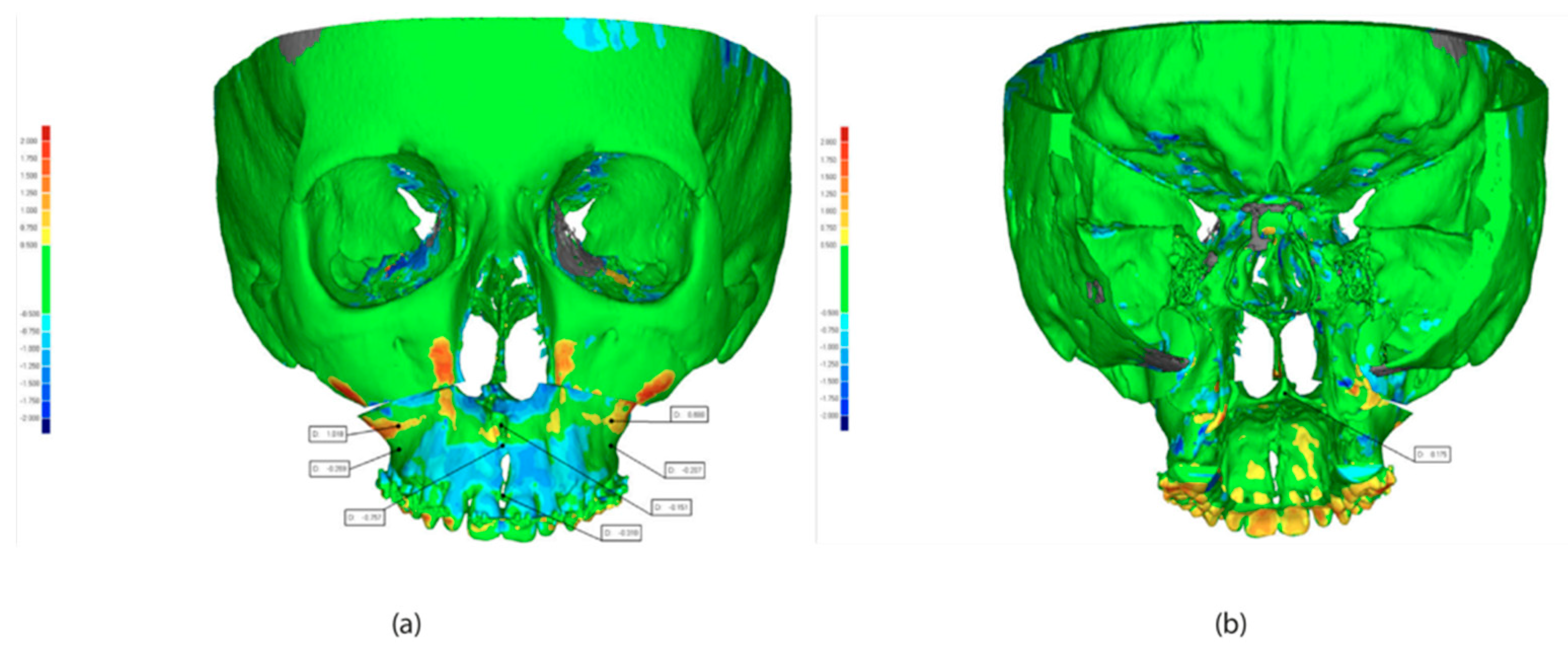 Coatings 12 01463 g011 Coatings 12 01463 g011