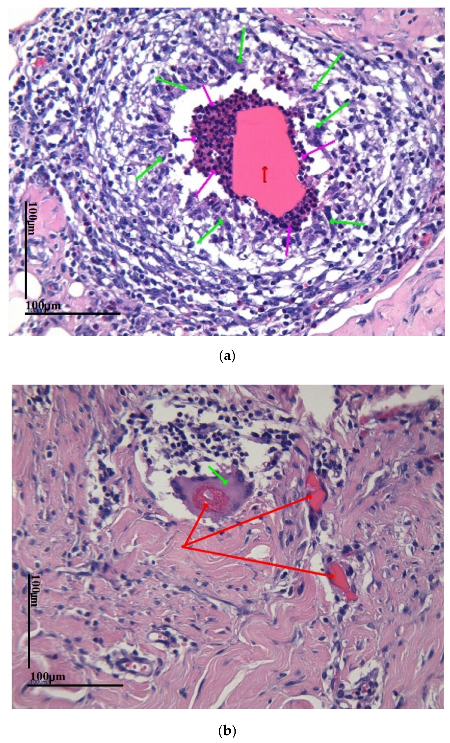 Coatings 13 00019 g006