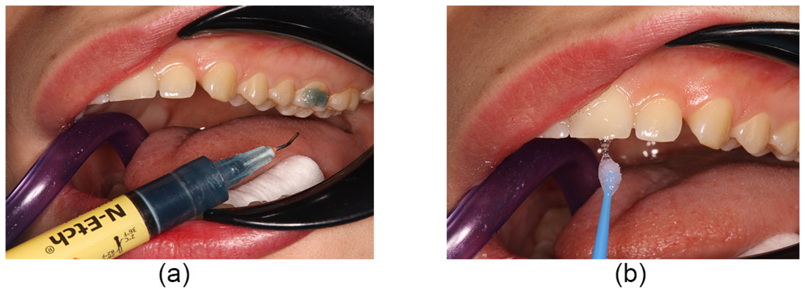 Coatings 13 01635 g001 Coatings 13 01635 g001