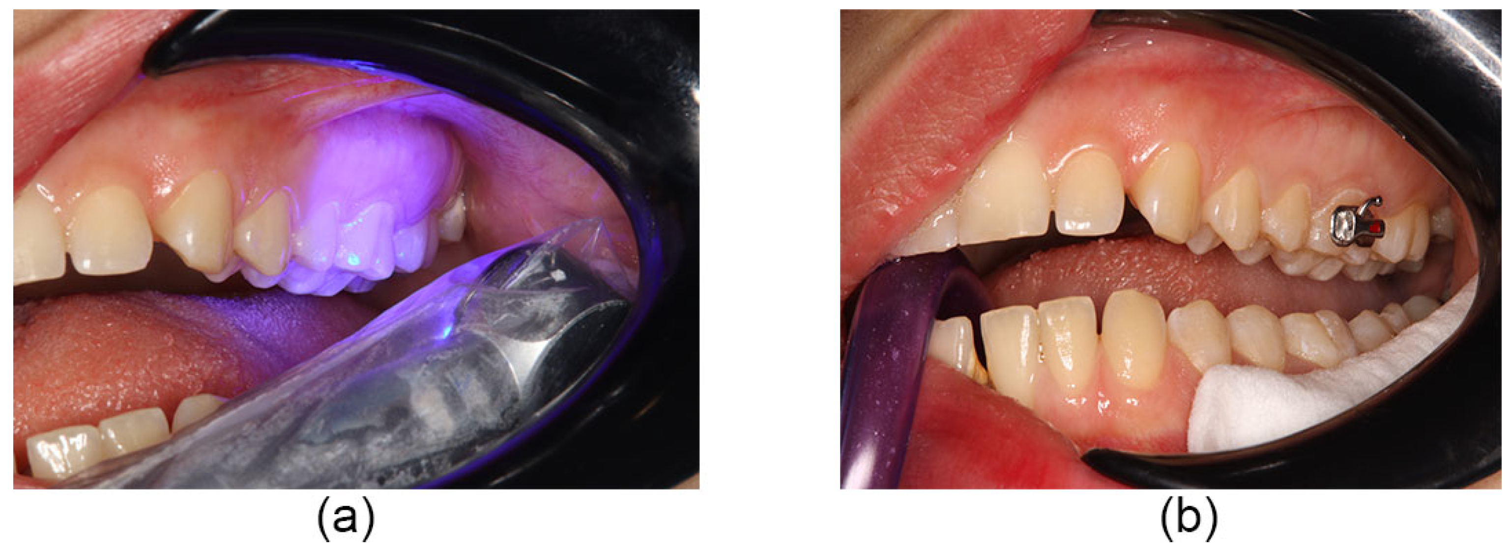 Coatings 13 01635 g003 Coatings 13 01635 g003