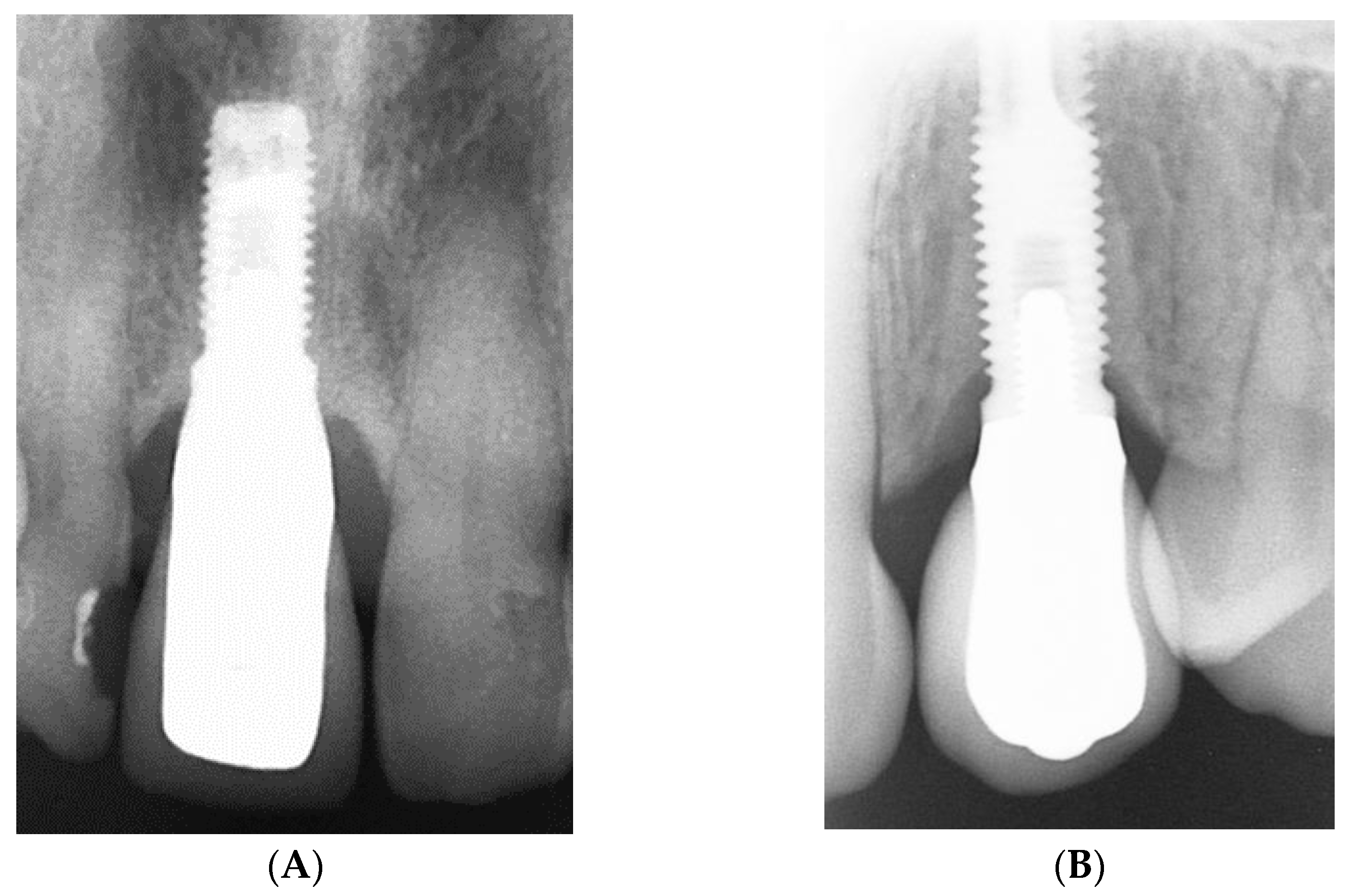 Coatings 13 01976 g011