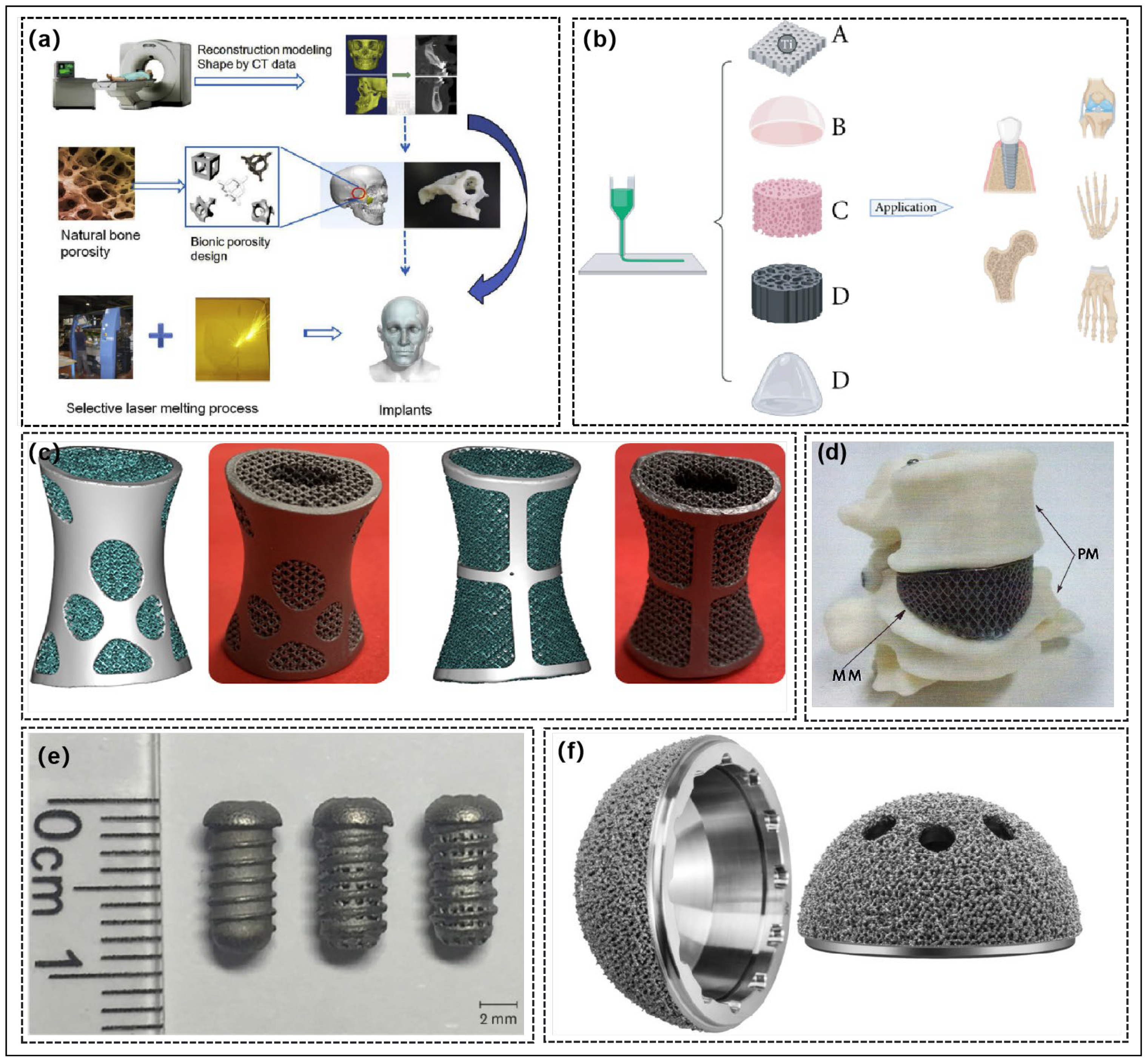 Effect of 3D-Printed Porous Titanium Alloy Pore Structure on Bone 