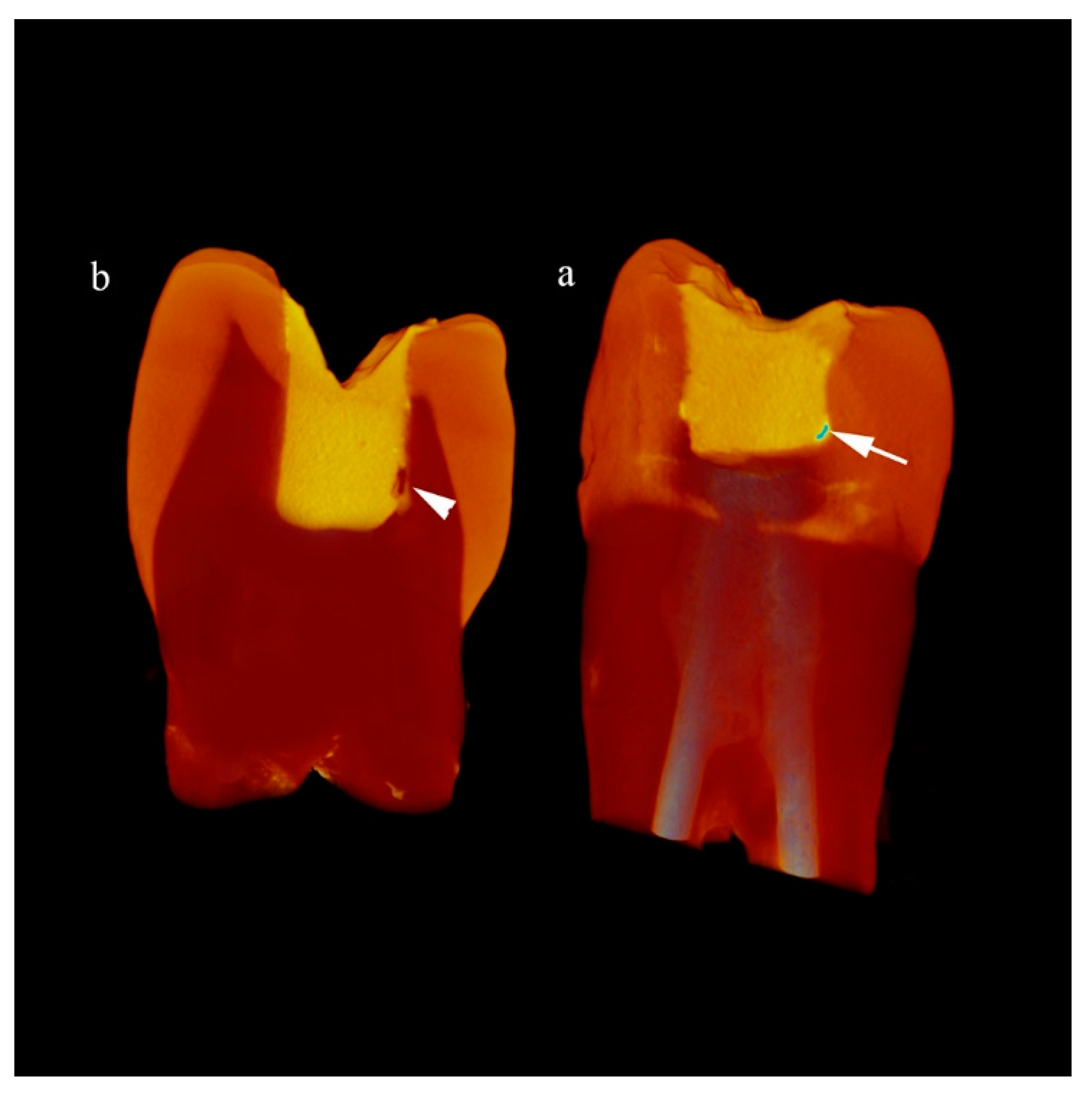 Coatings 14 00329 g003
