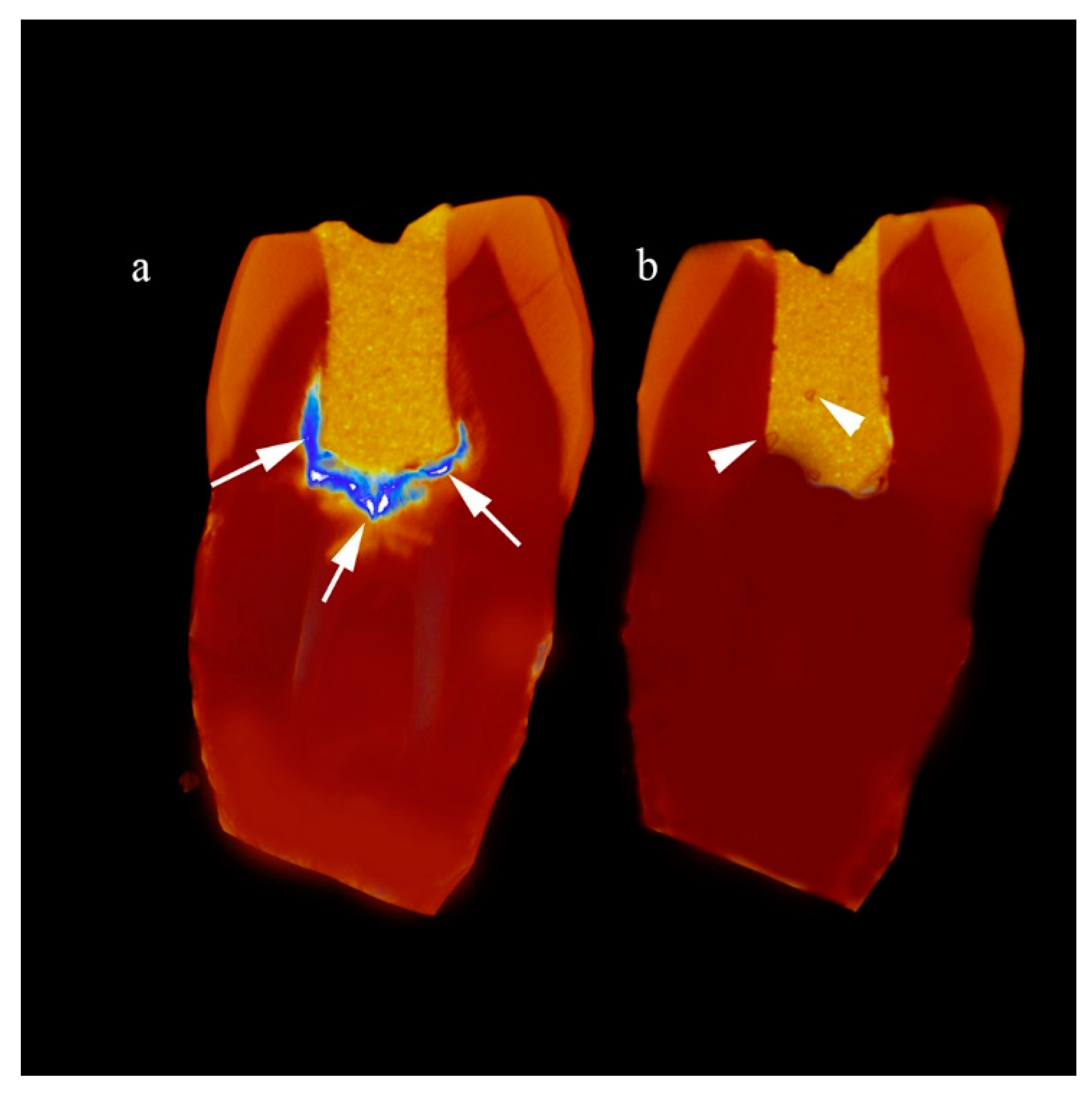 Coatings 14 00329 g004