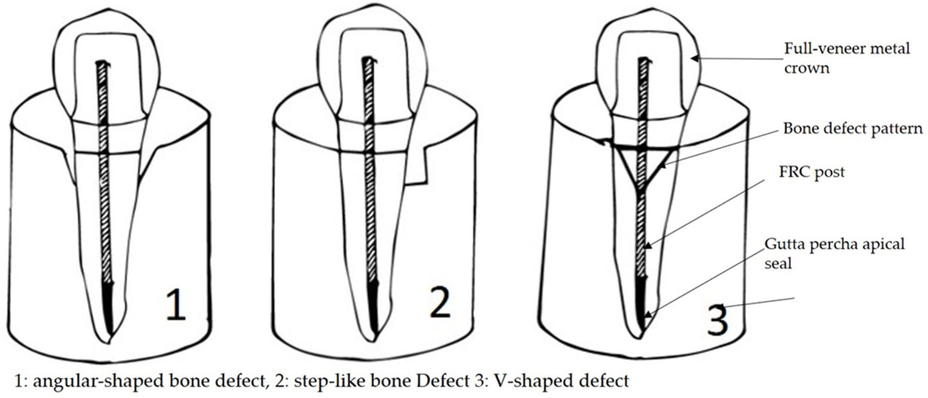 Coatings 14 00661 g001