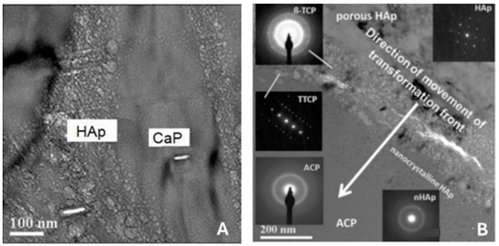 Plasma-Sprayed Osseoconductive Hydroxylapatite Coatings for