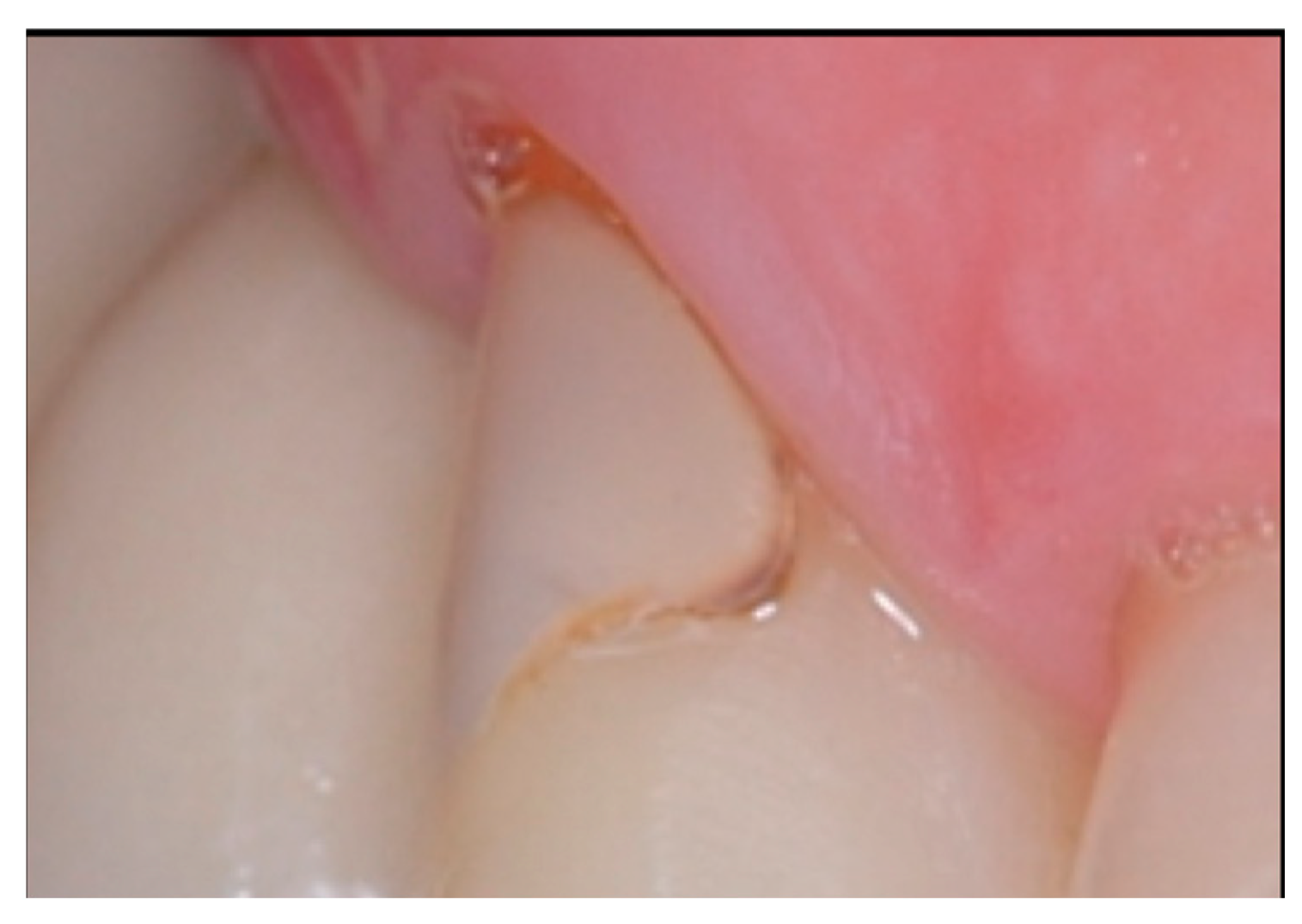 Coatings 14 01618 g001