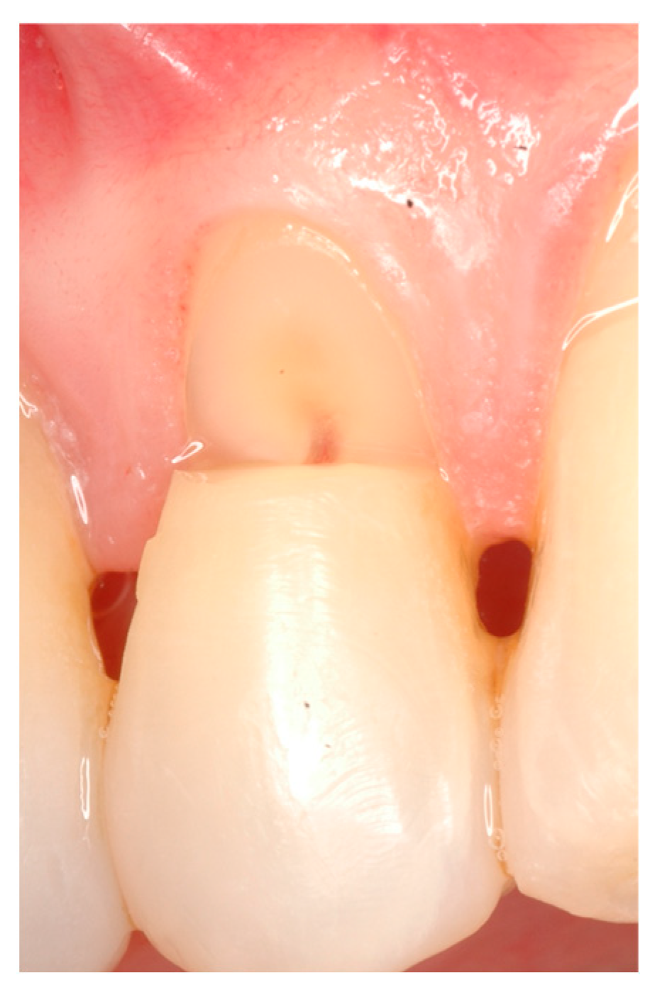 Coatings 14 01618 g002