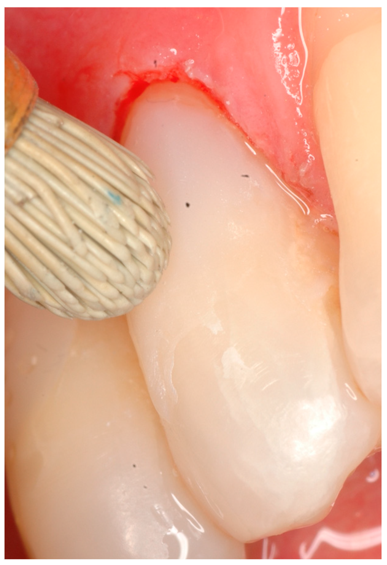 Coatings 14 01618 g004